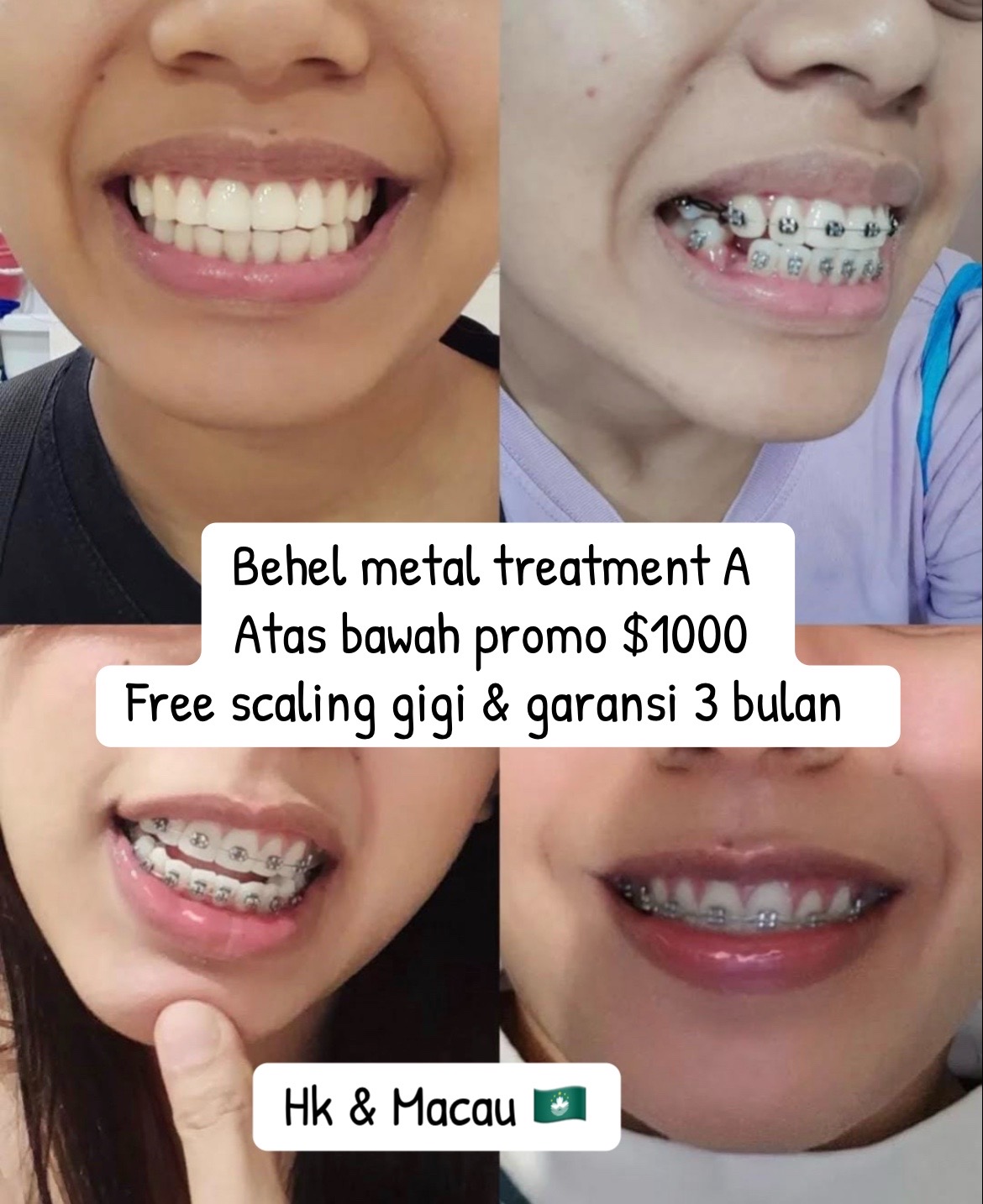 @mbak-Paijem