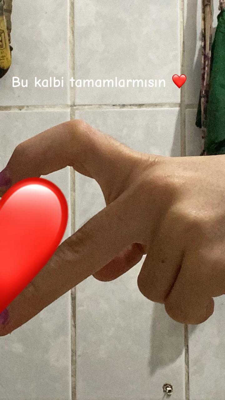 @Hilal yelekçi