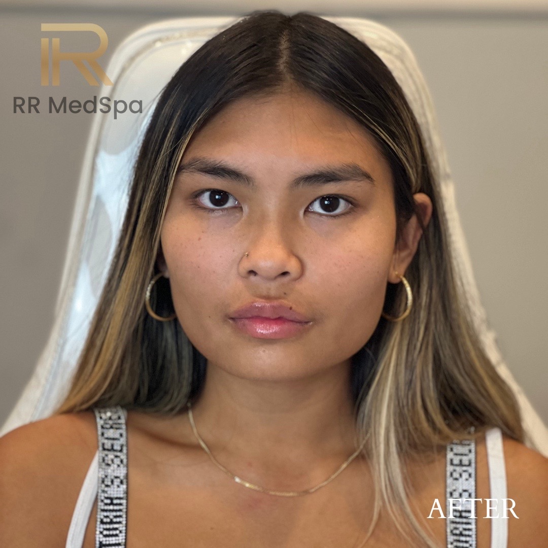 @RR Medspa