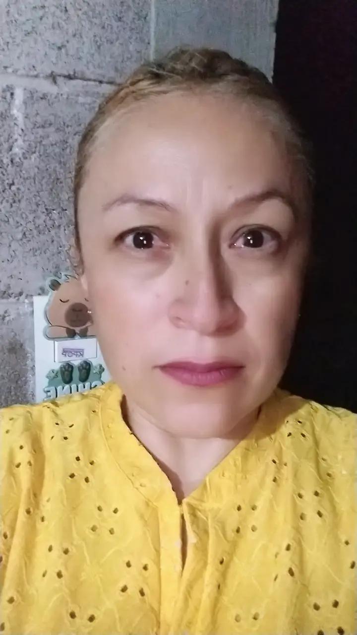 @Yolis