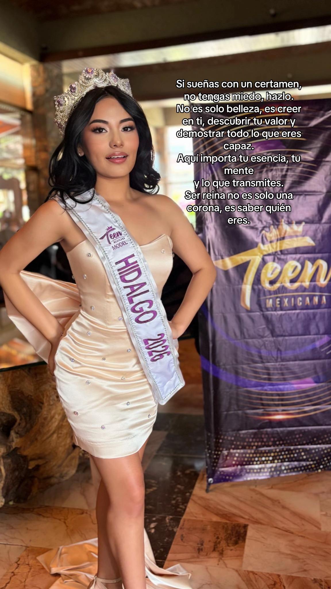 @Modelaje Pachuca 👠📸👑