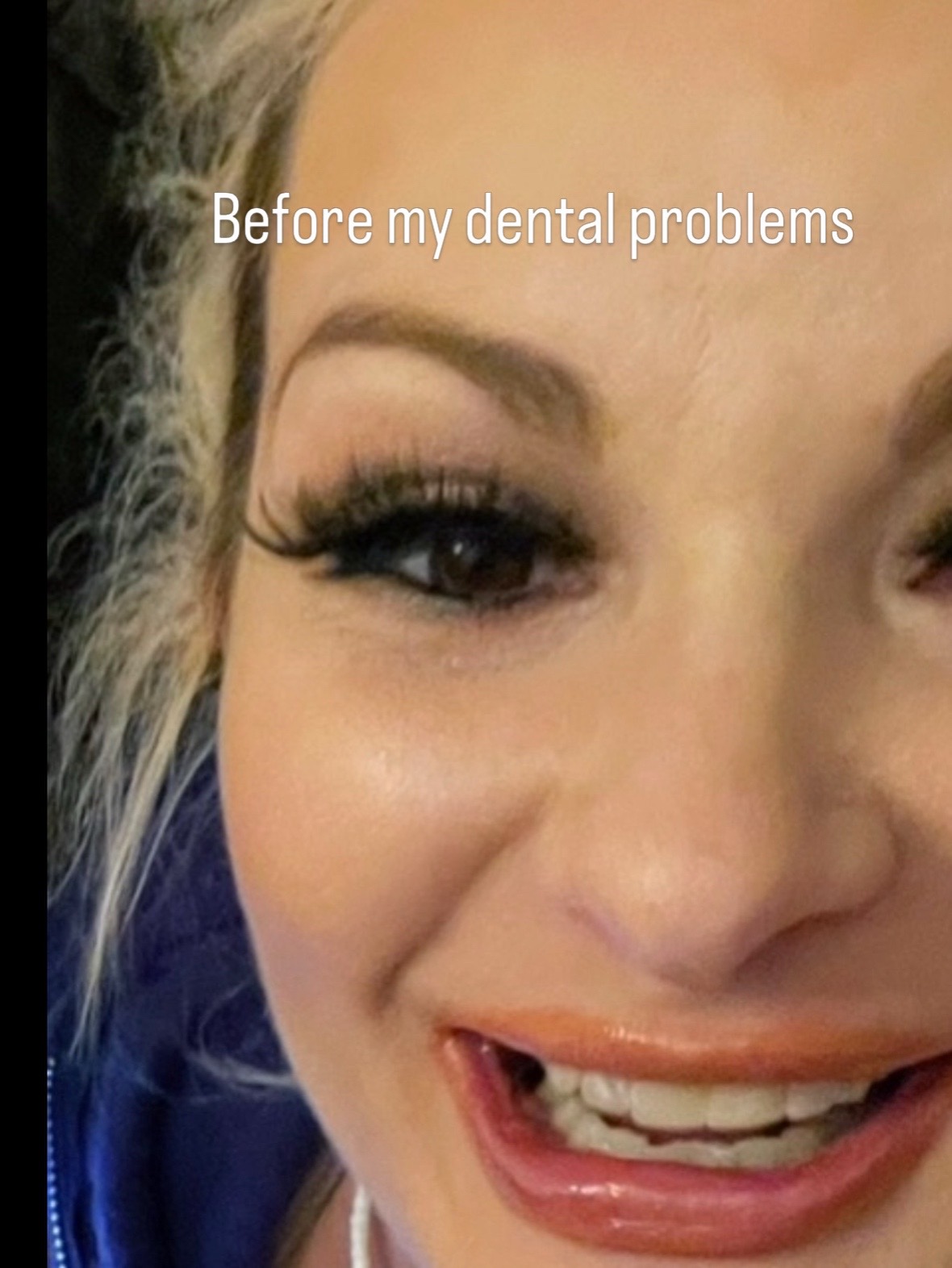 @DentureDiaries