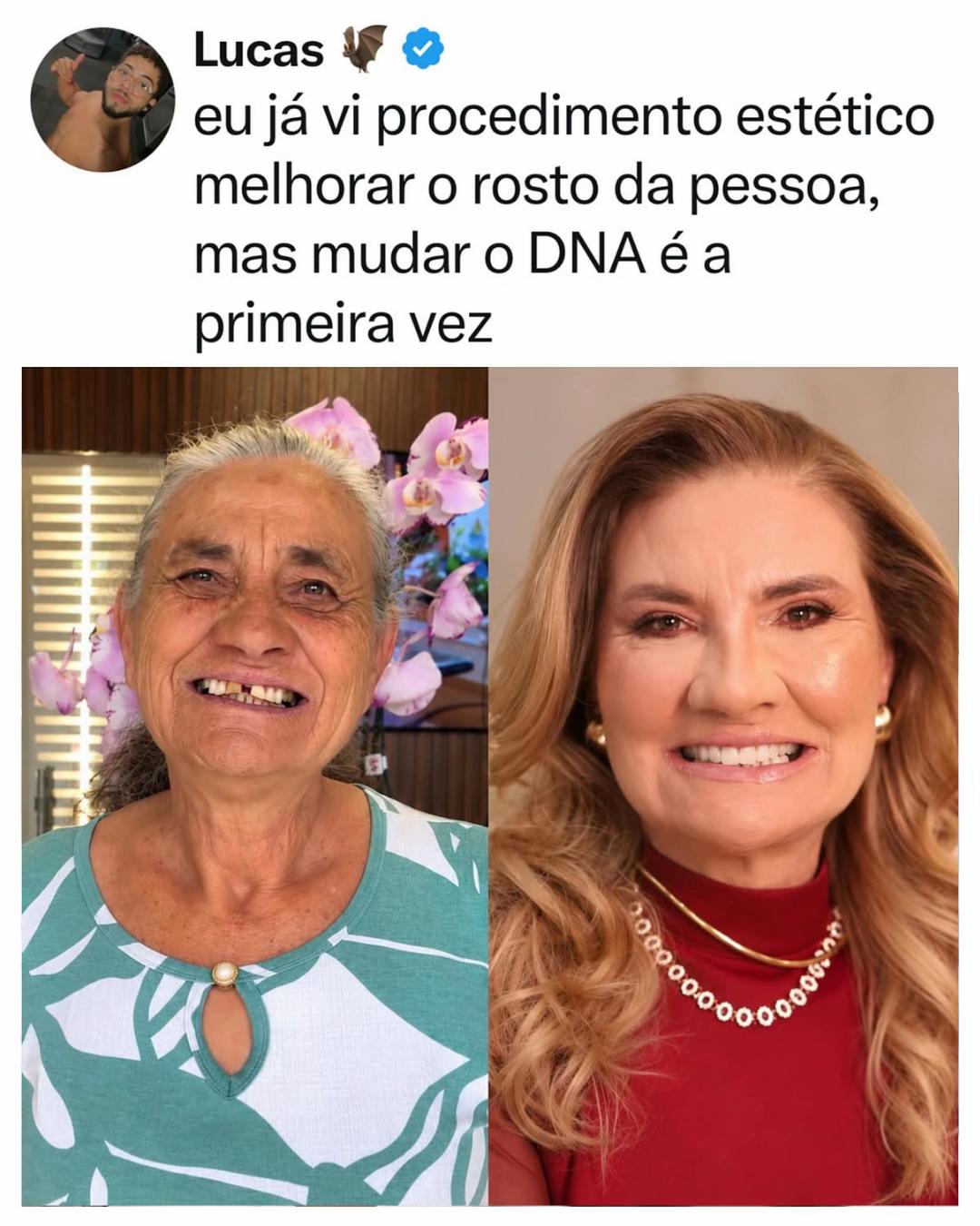 @Alfinetei