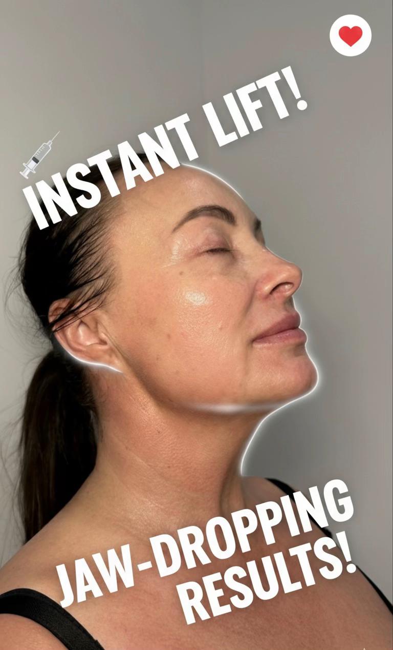@soul_laeseraesthetic