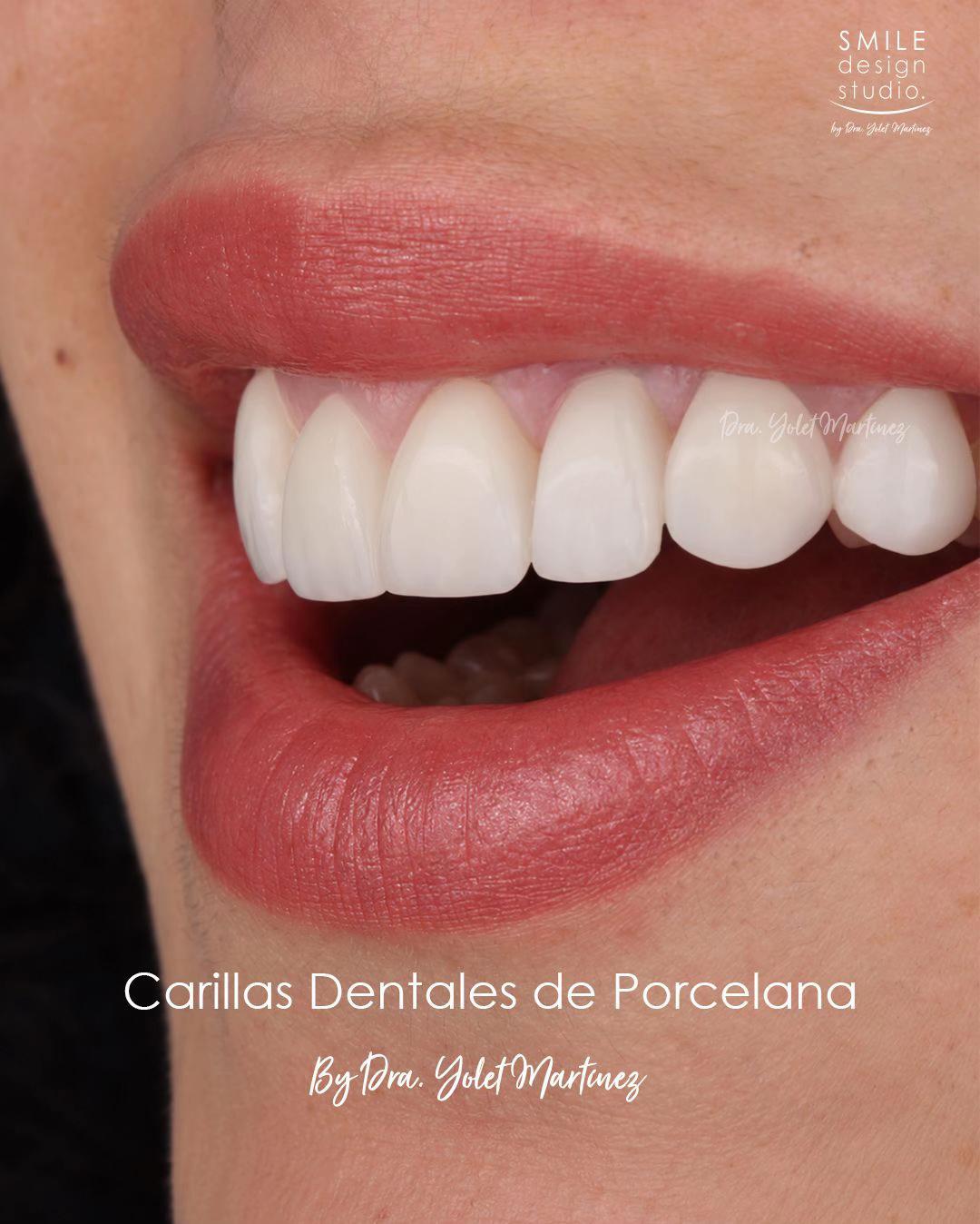 @SmileDesignStudio