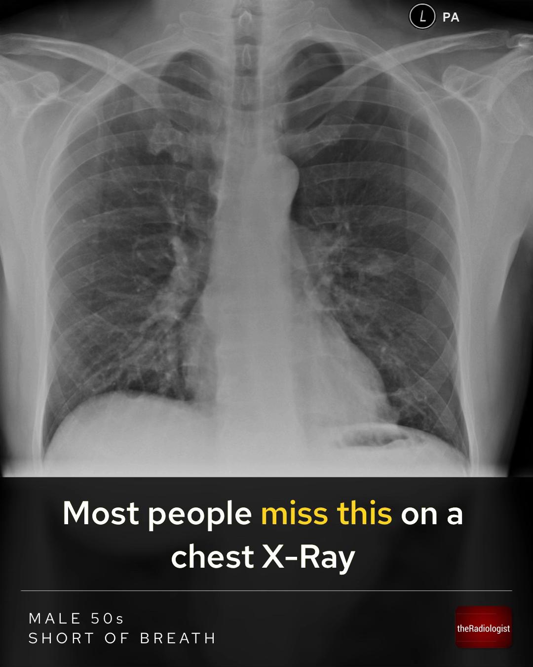 @The Radiologist