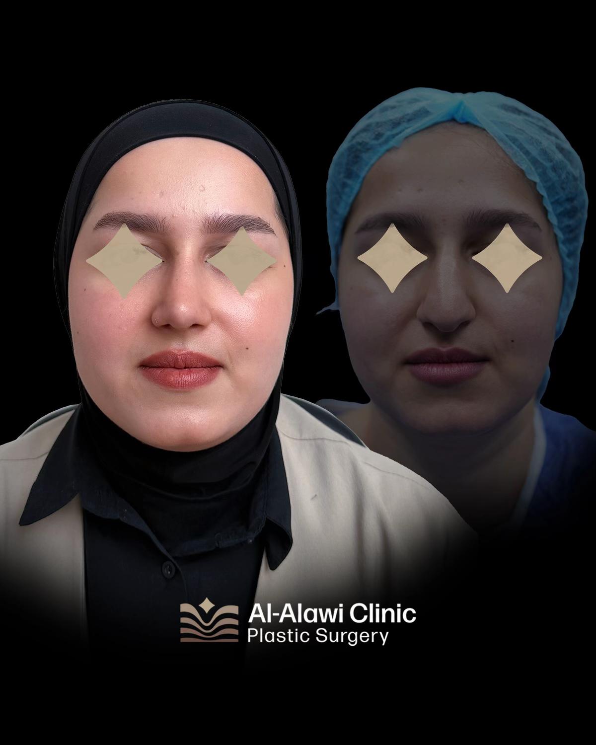 @dr.mhmd.alalawi