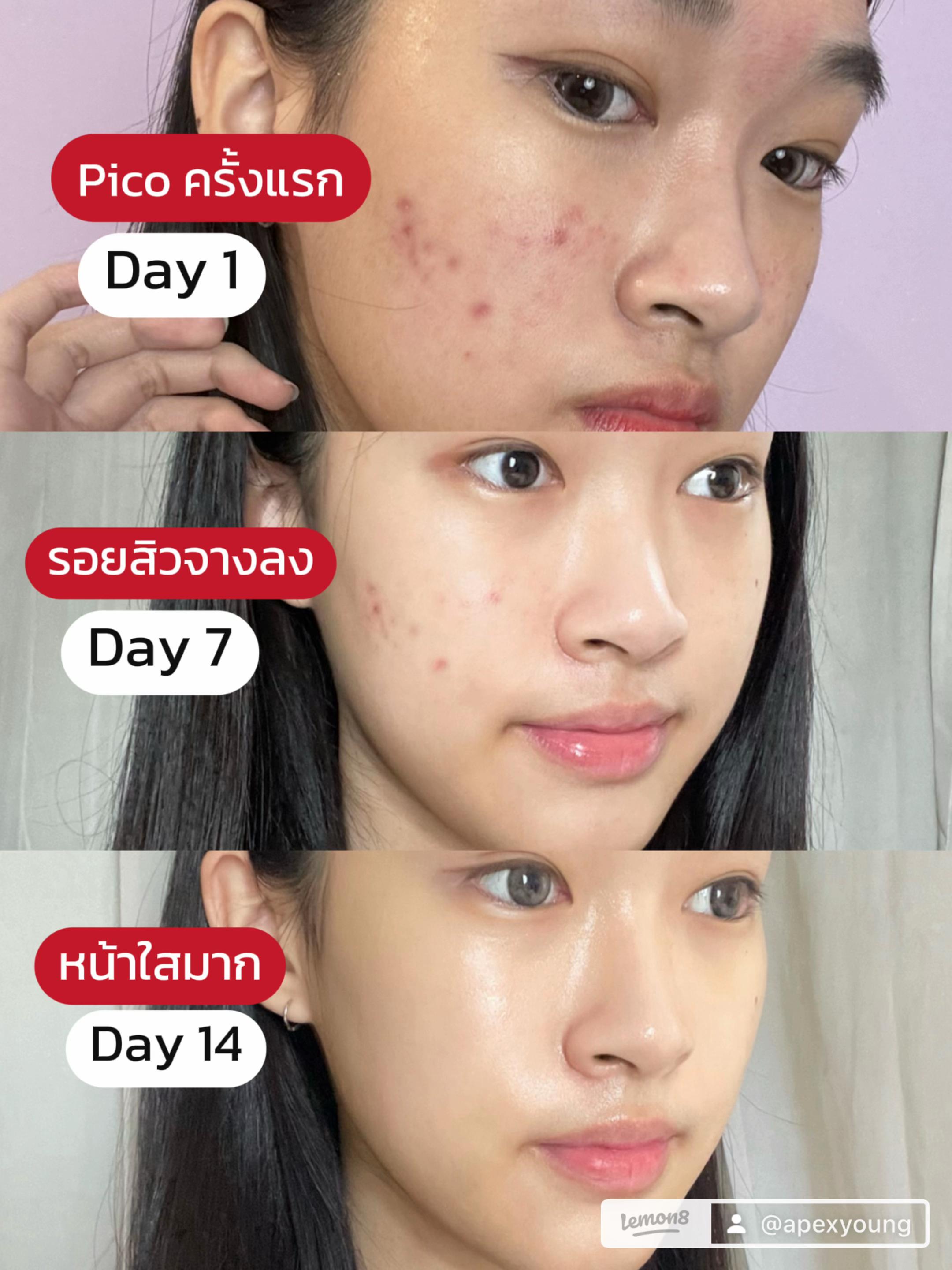 @APEXYOUNGCLINIC