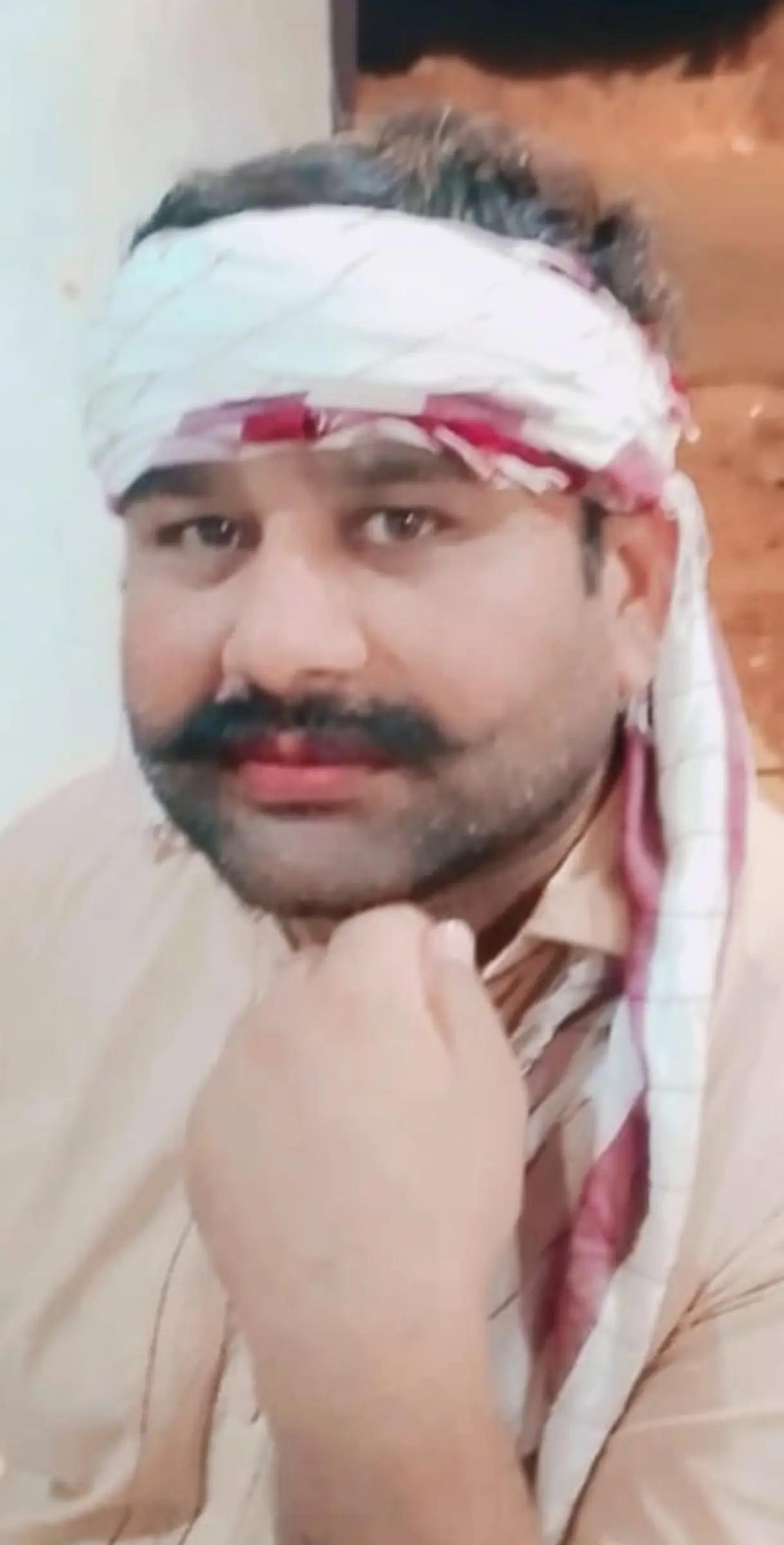 @Azhar Kalal