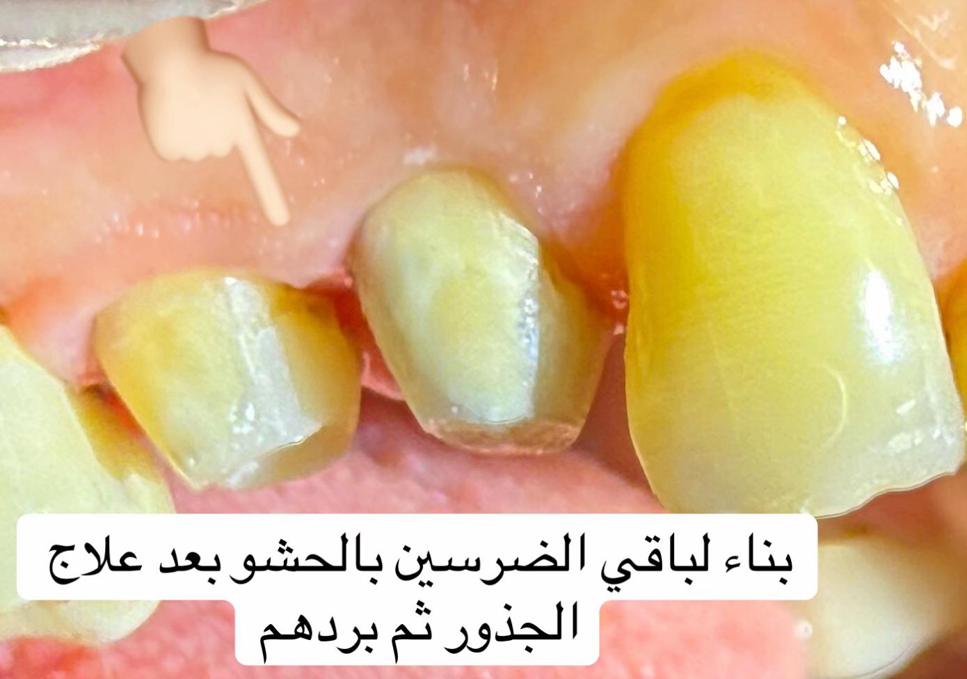 @Dr.Manar Samy