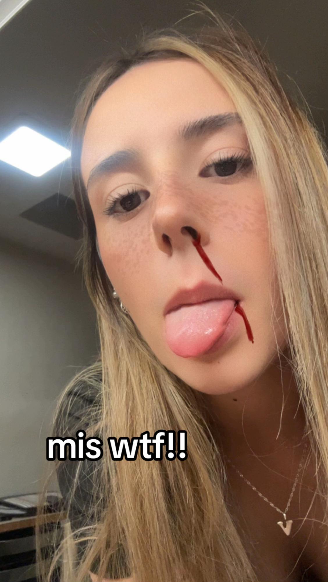@vic