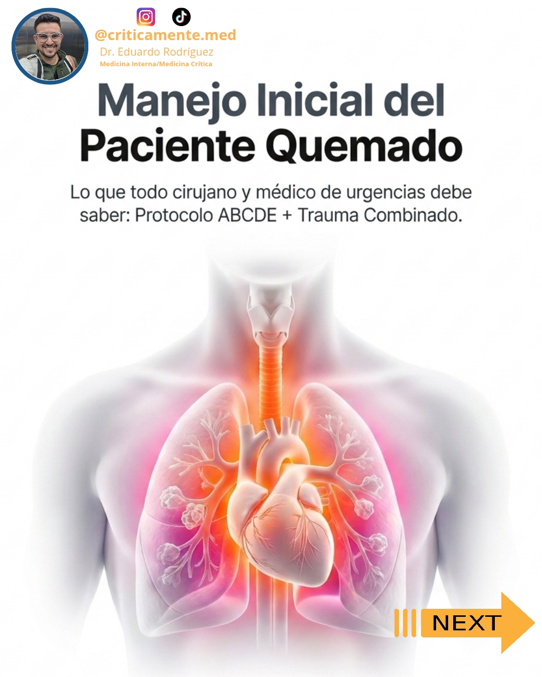 @Criticamente