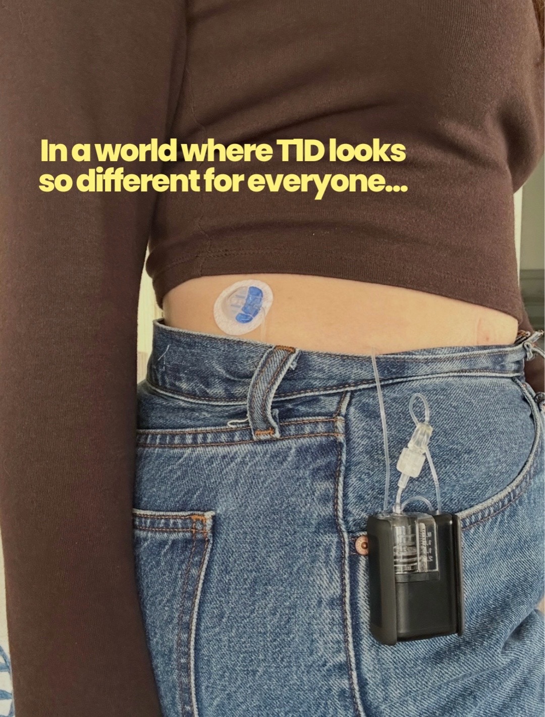 @Raquel Baron | T1D
