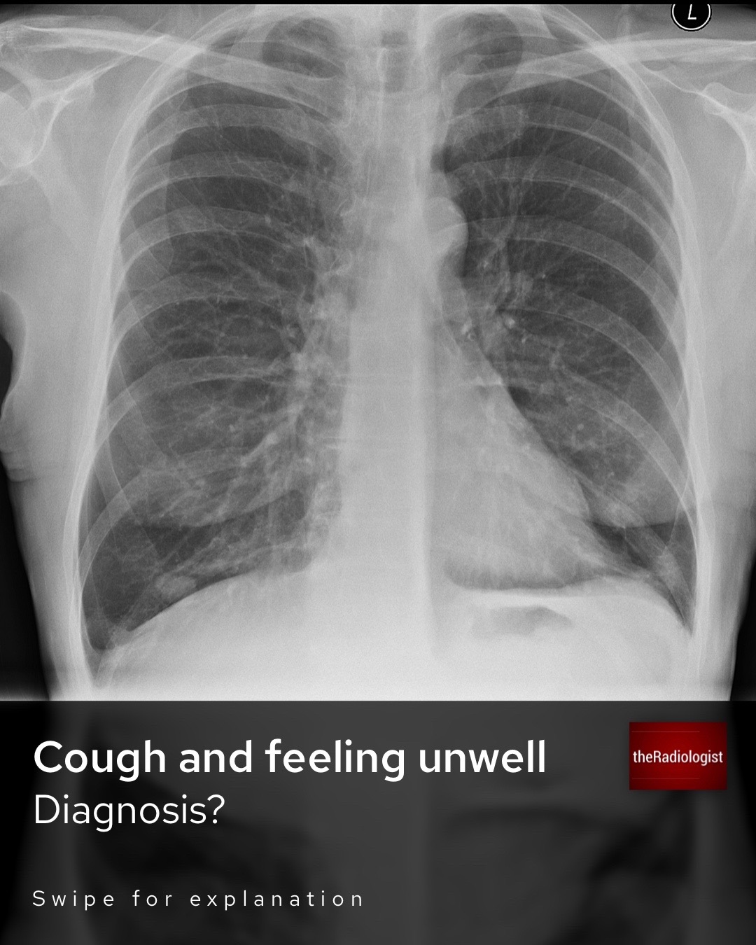 @The Radiologist