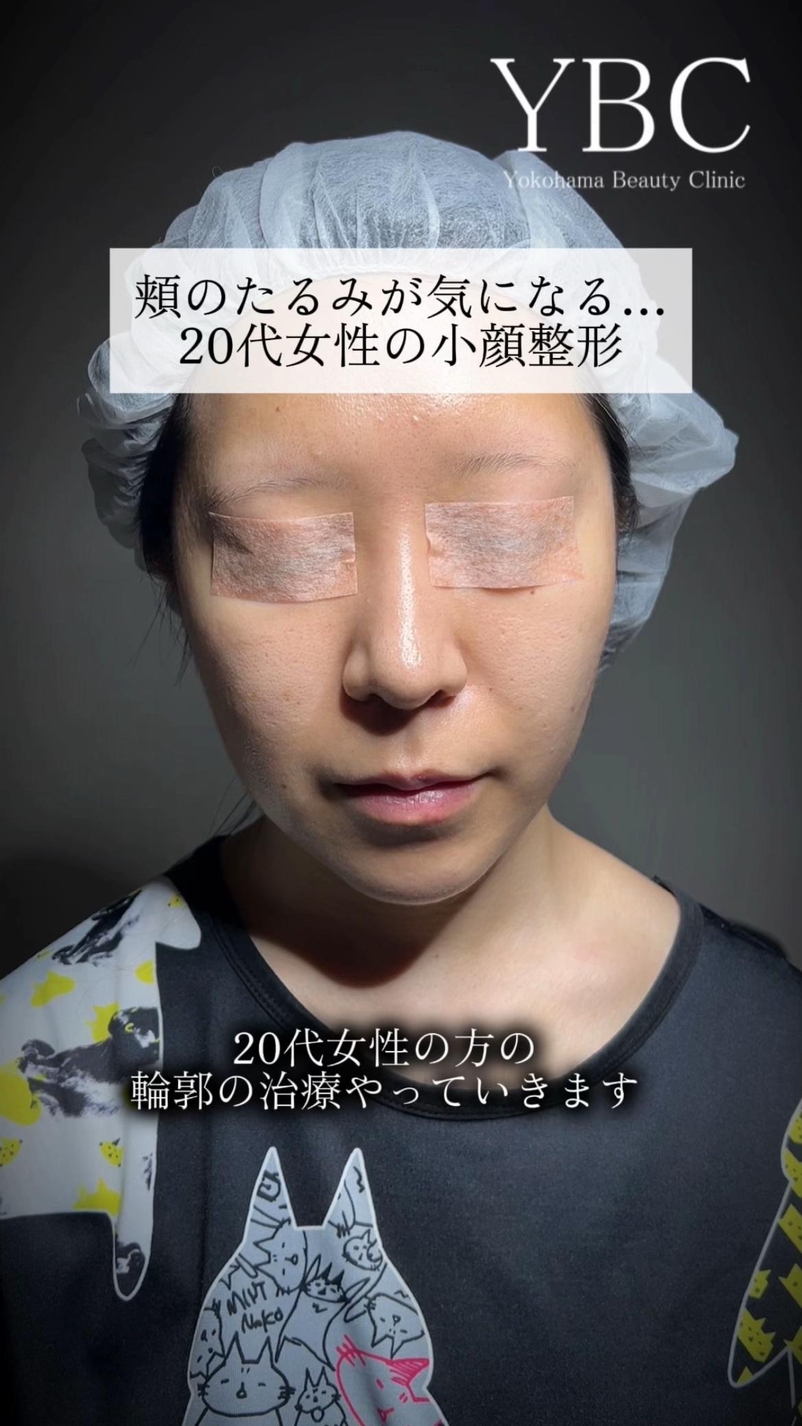 @イソセン/美容外科医（磯村亮輔院長）