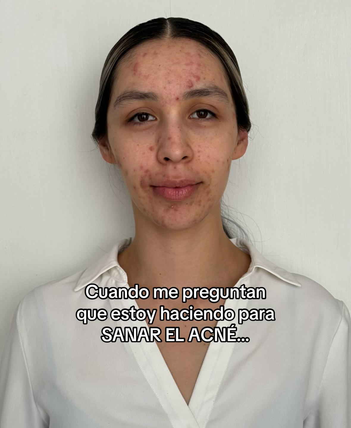 @yulmadeaussa