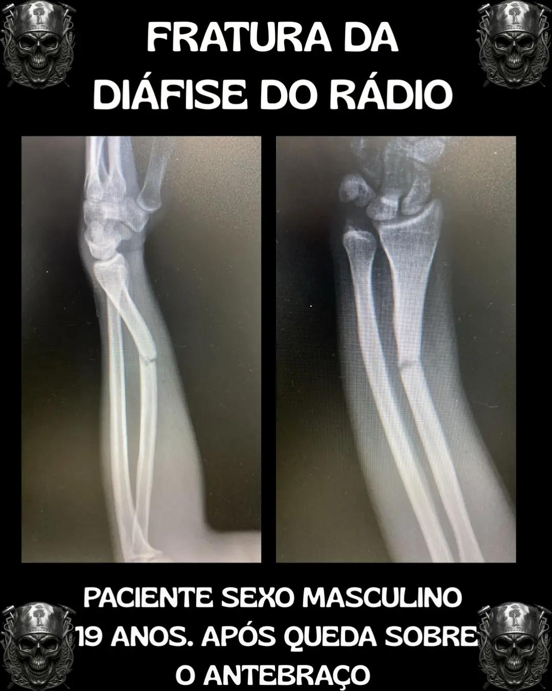@Traumatologia Maluca
