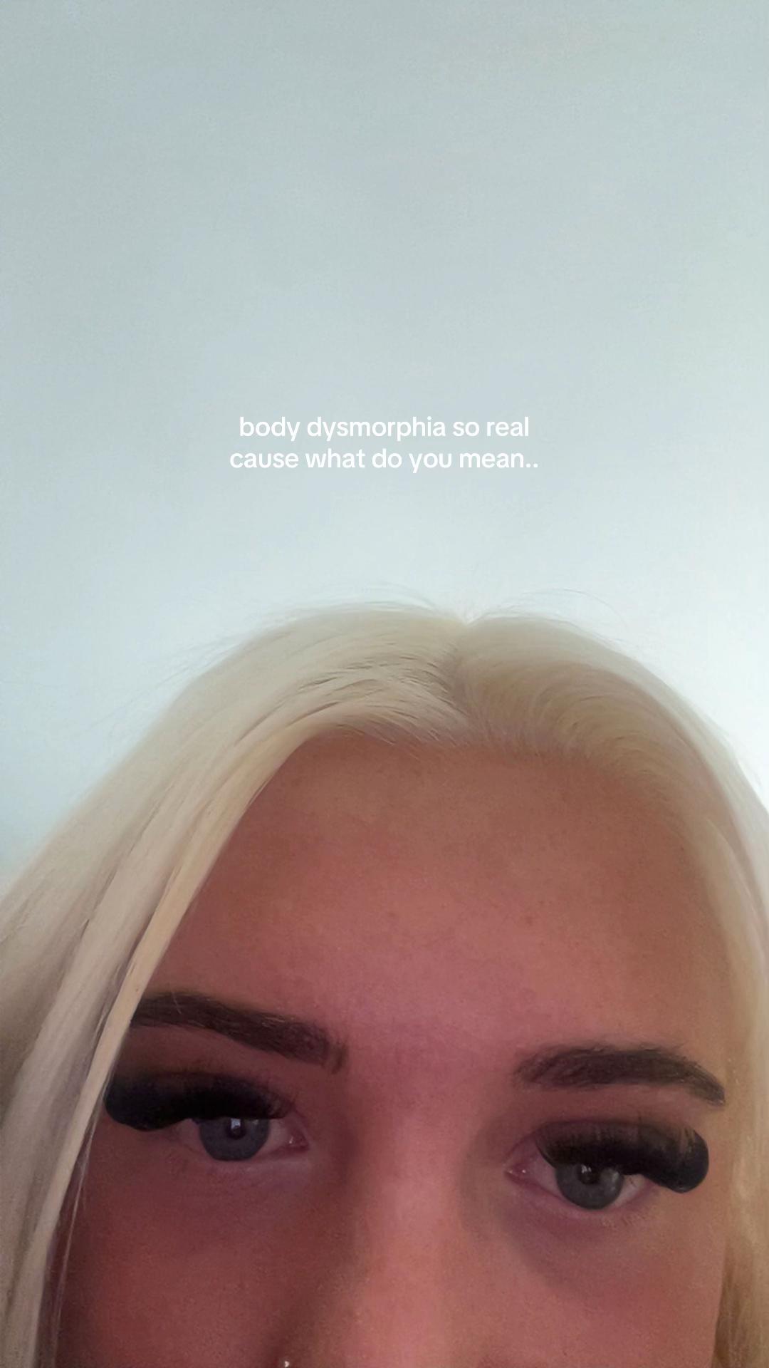 @Case