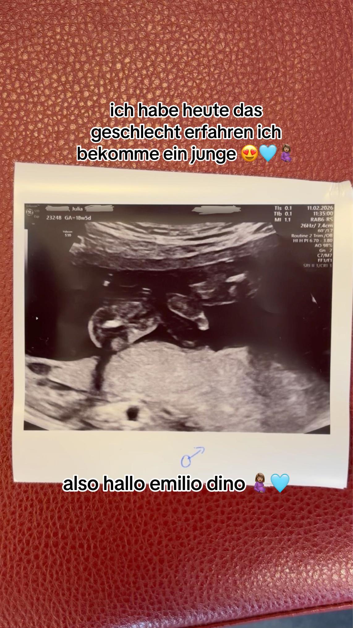 @𝓑𝓸𝔂 𝓜𝓸𝓶 🩵🤰🏽