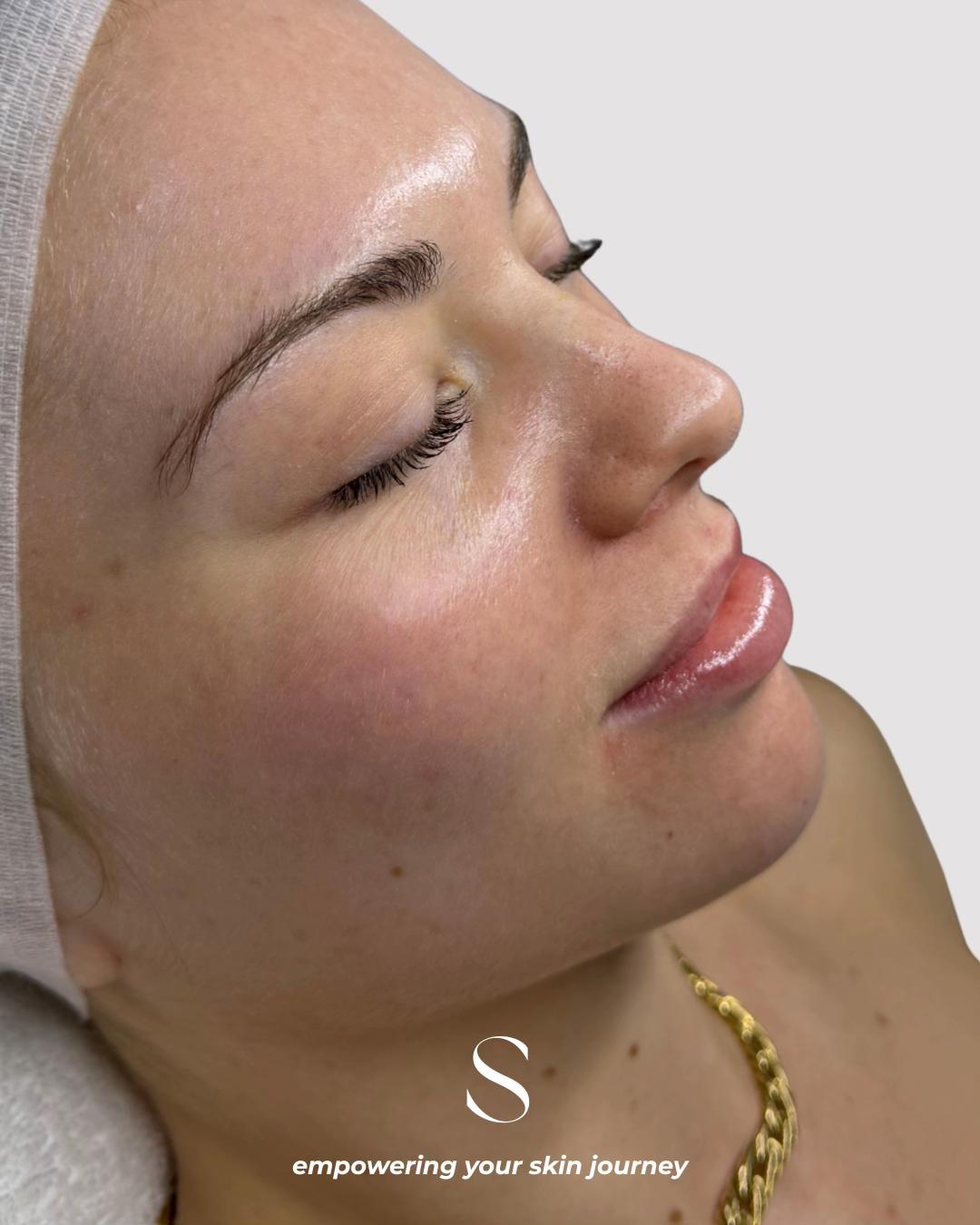 @Skinformative