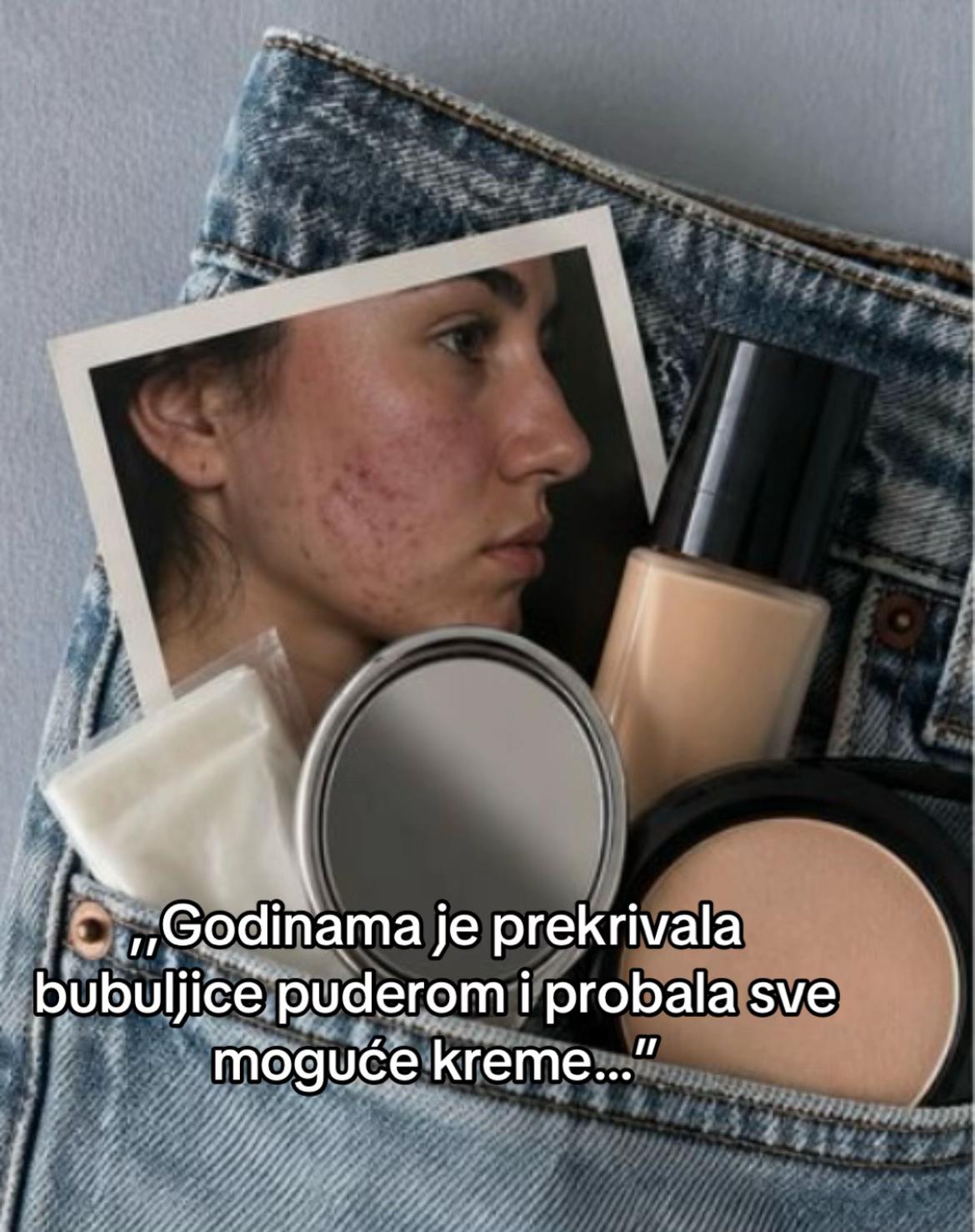 @obrisii.flekice