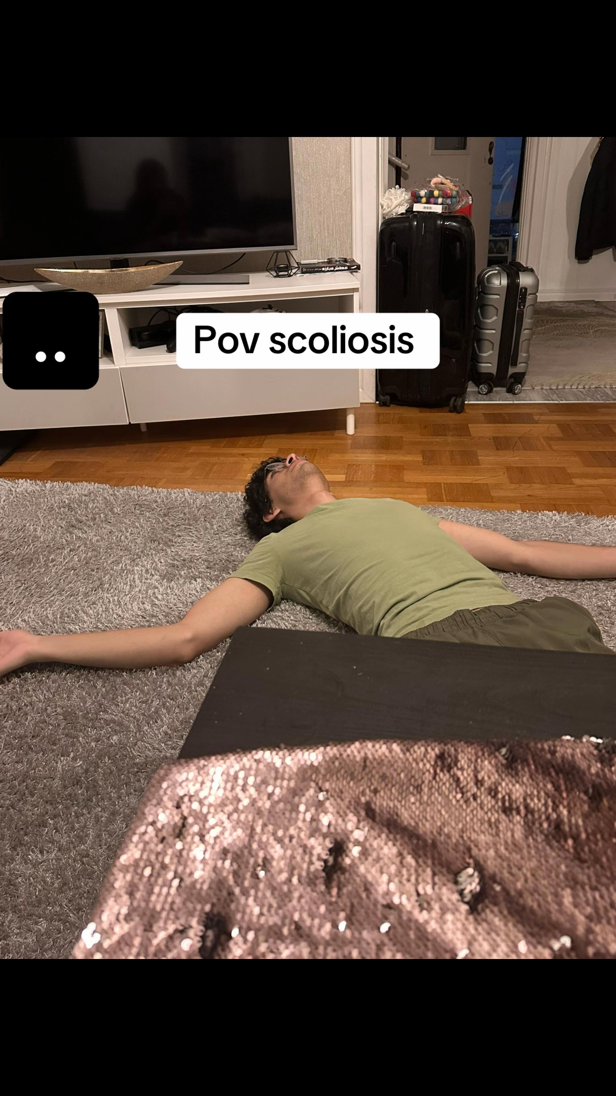 @Yasamin [Scoliosis]