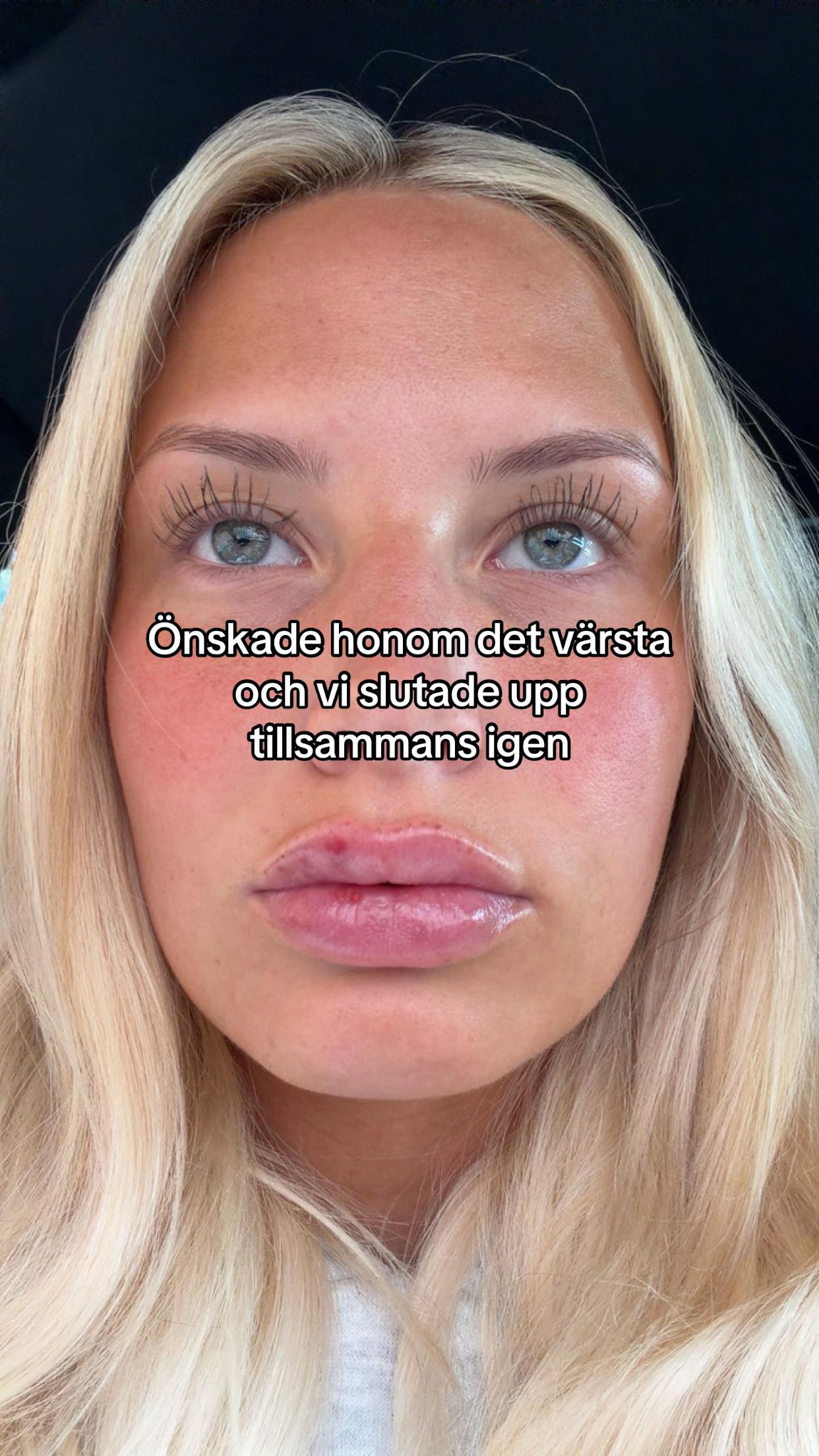 @Ebba Segerberg
