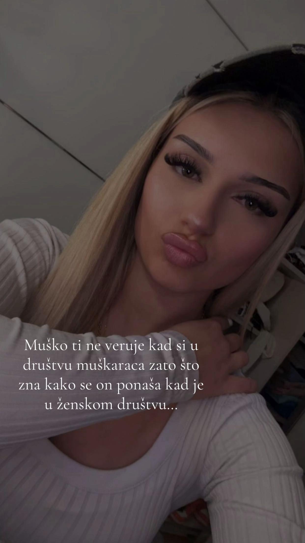 @555