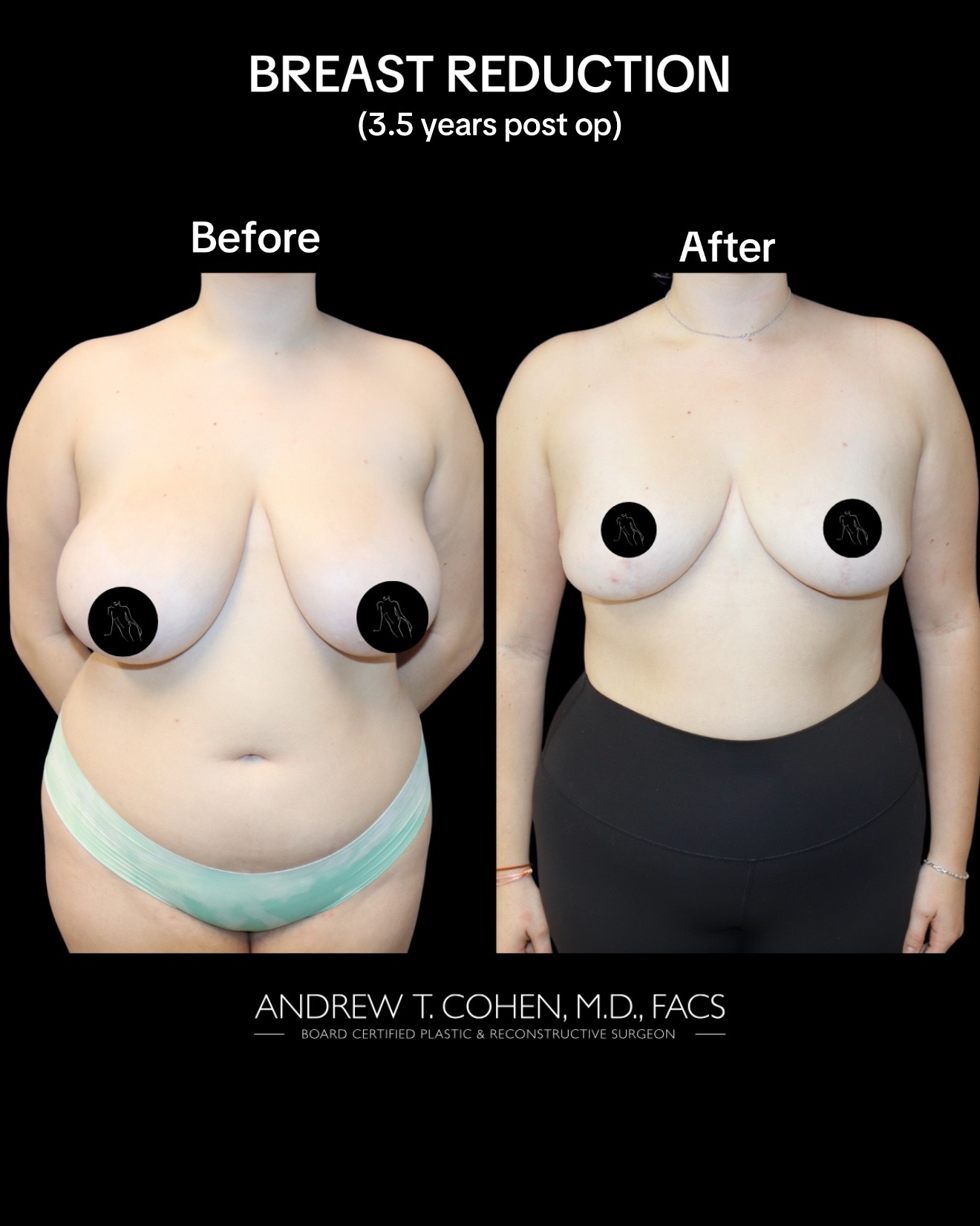 @Cohen MD Plastic Surgery