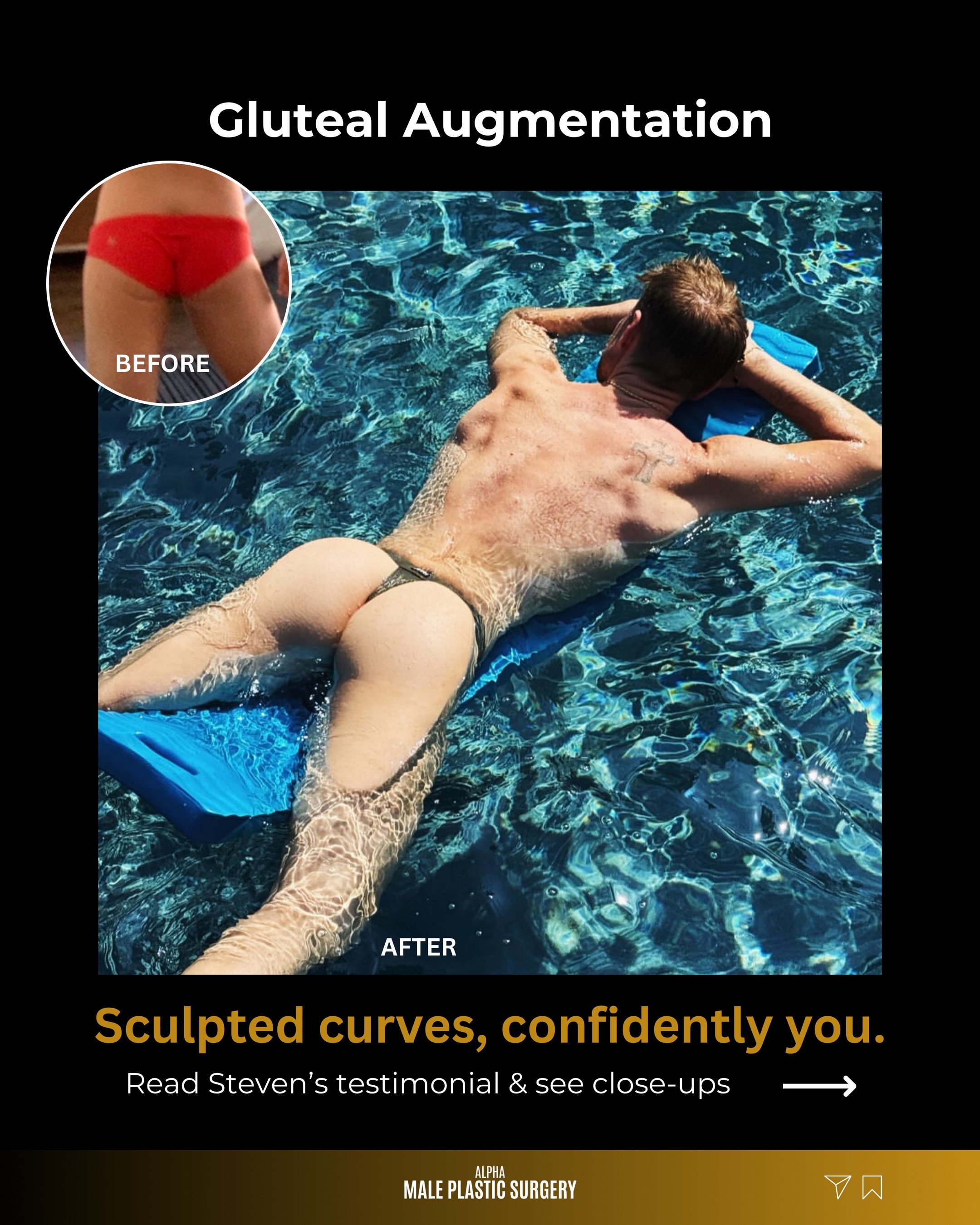 @mensplasticsurgery
