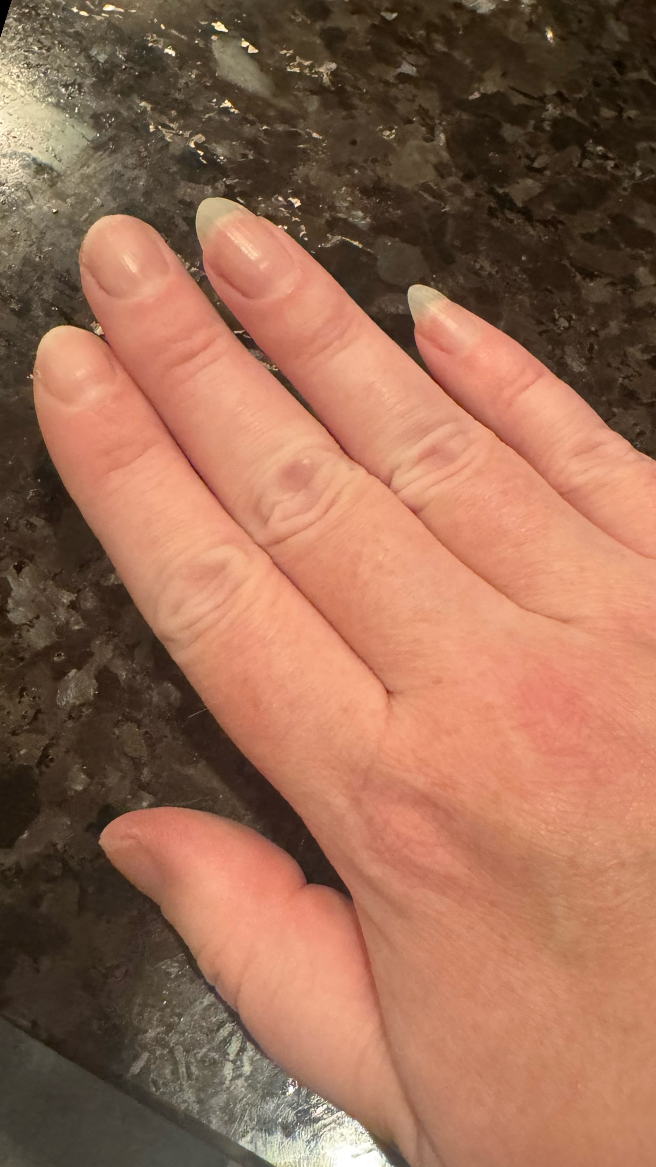 @Neurospice Beauty Electrolysis