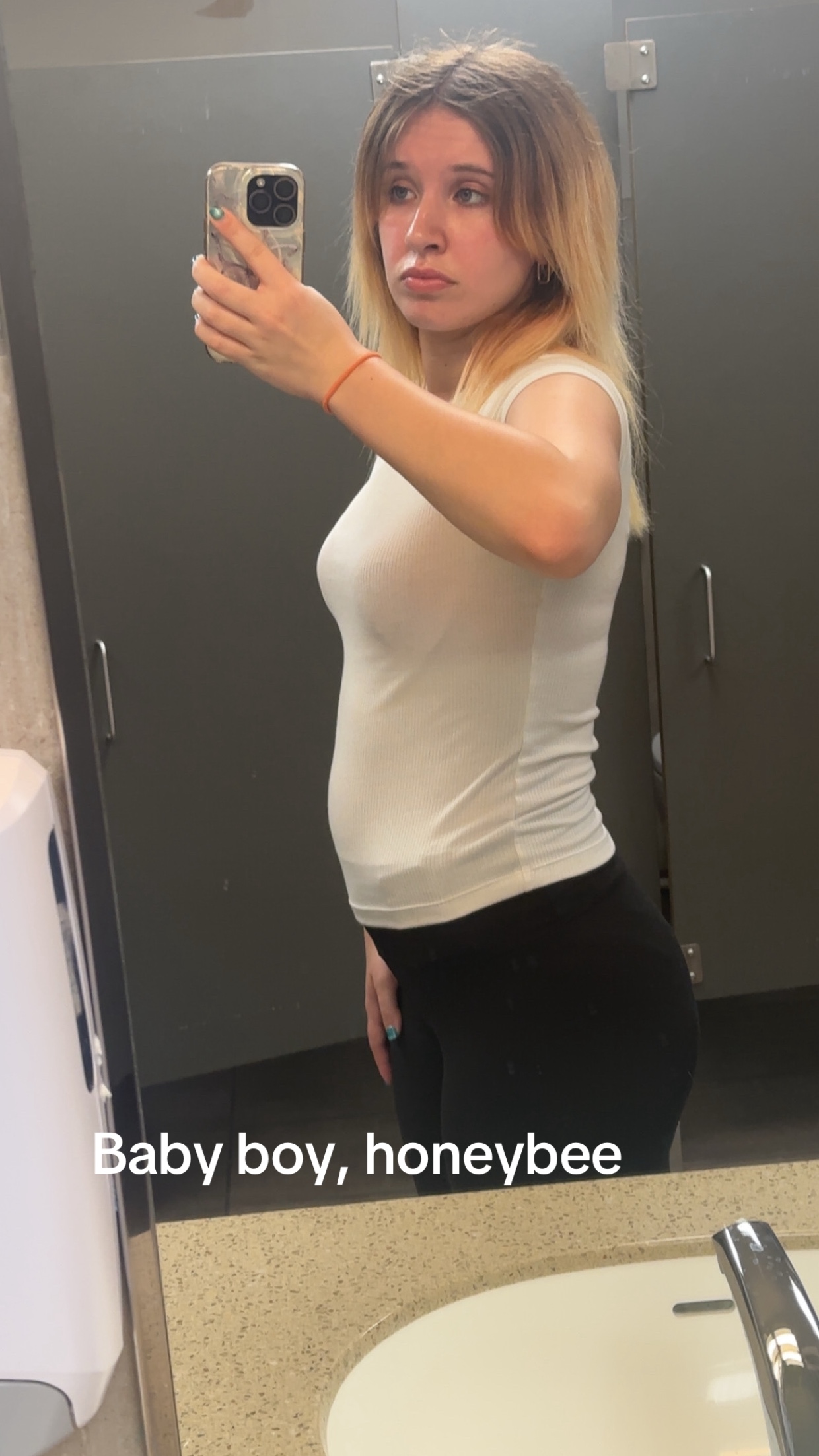 @Simmy Kantstandyourbitz