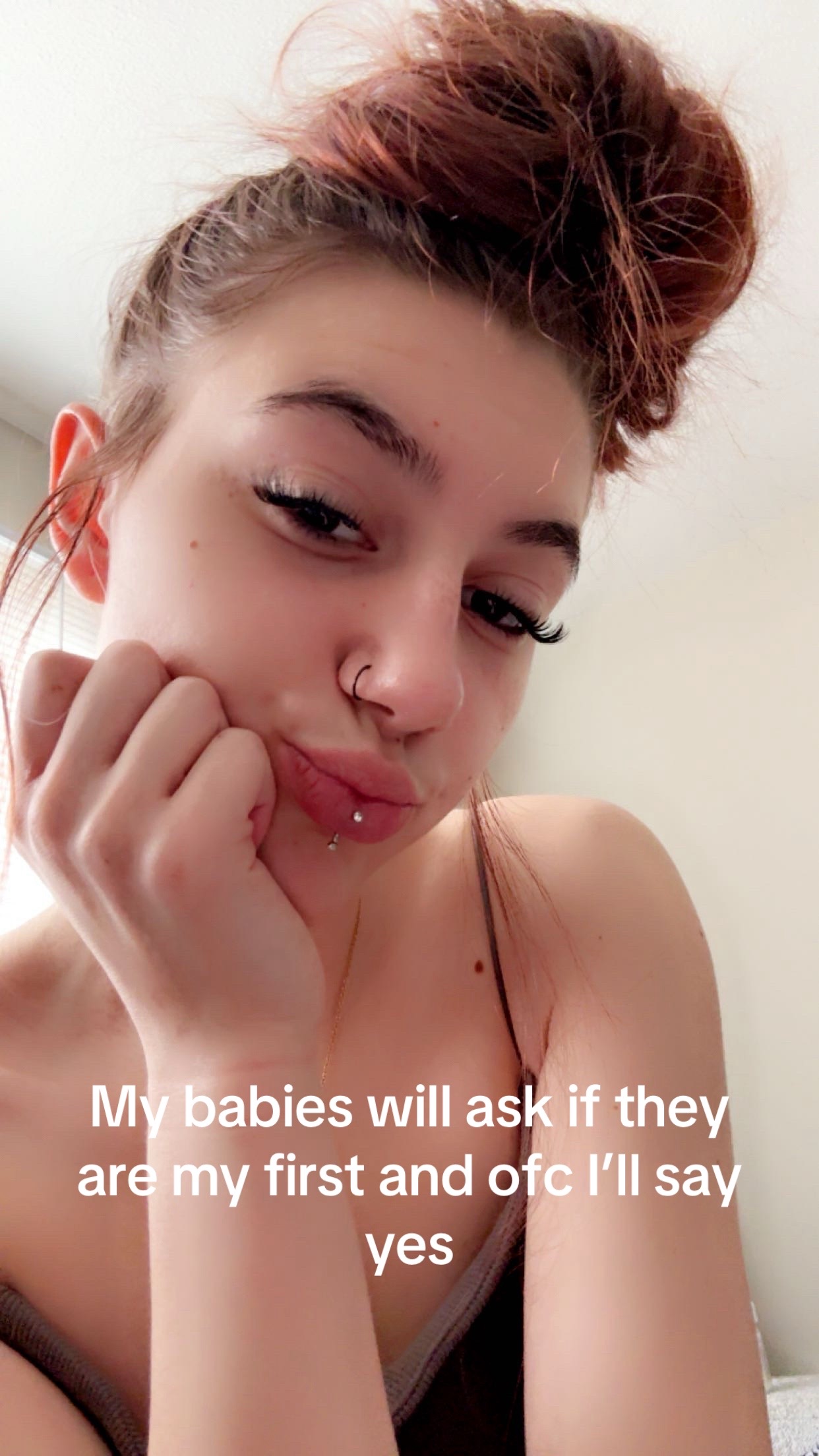 @mckenziebach