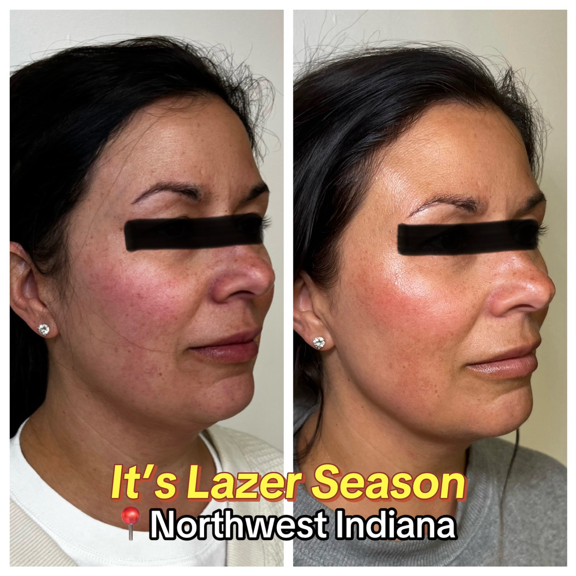 @Christy - NWI Aesthetic NP