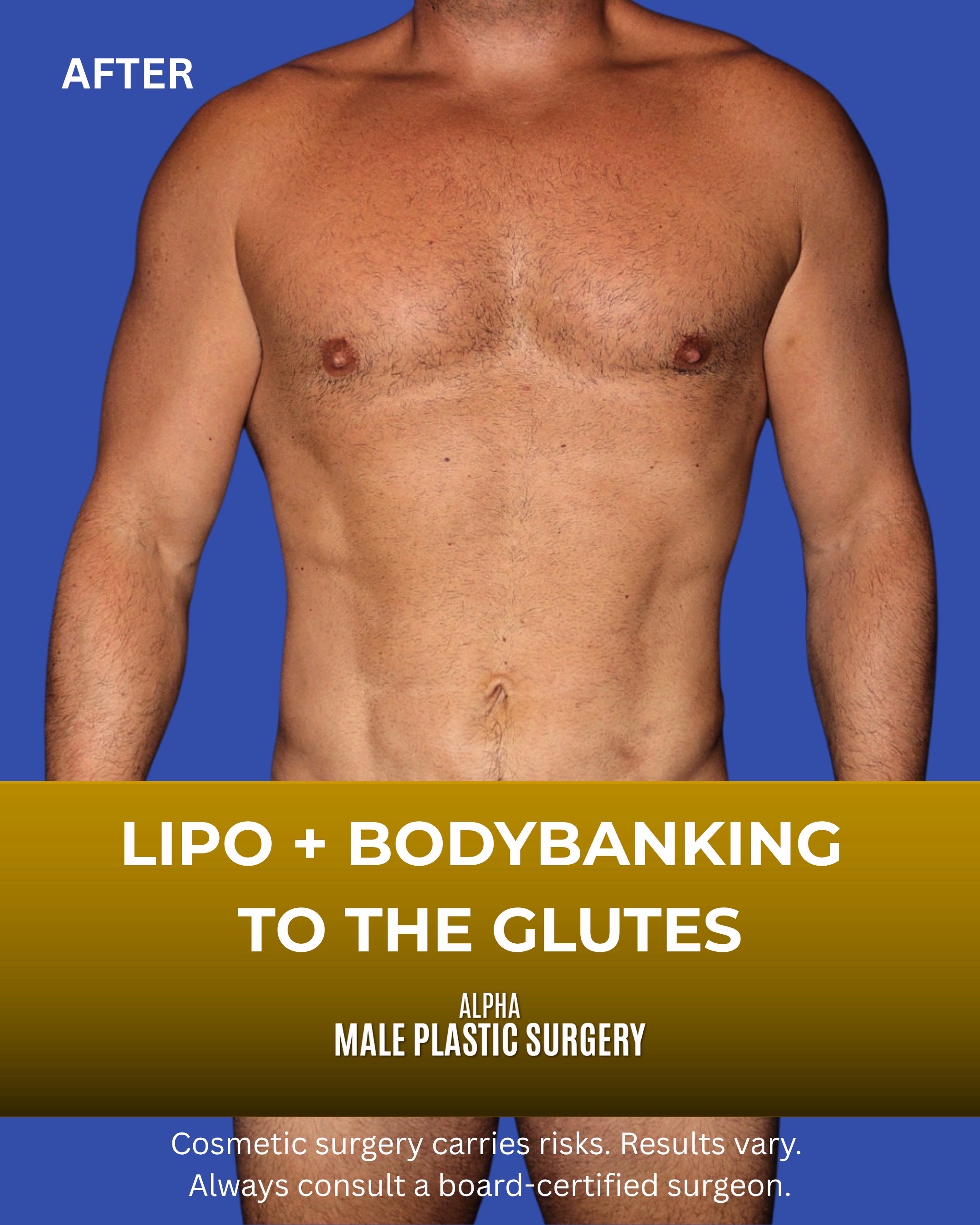 @mensplasticsurgery