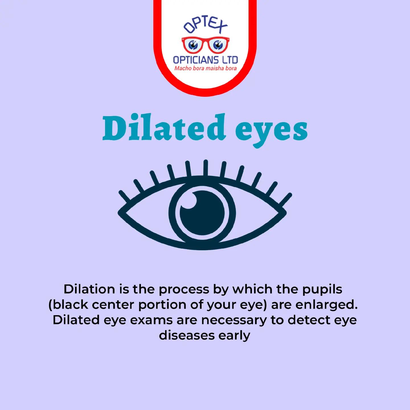 @Optex Opticians Ltd