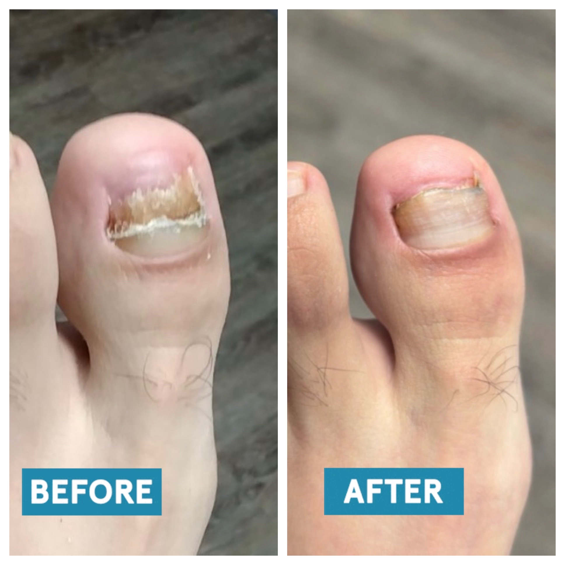 @Deniel Foot and Ankle Center