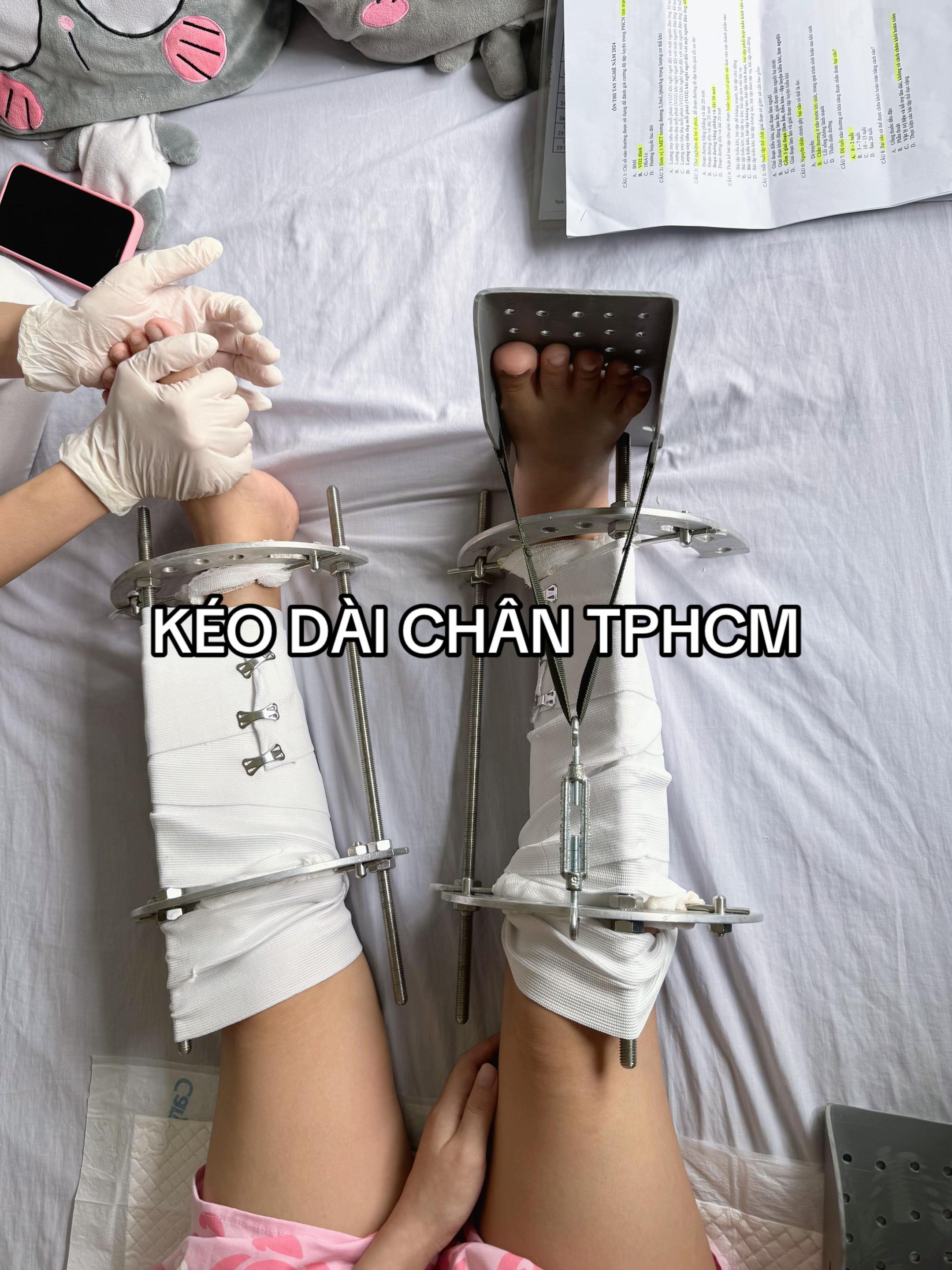 @K&eacute;o d&agrave;i ch&acirc;n TPHCM