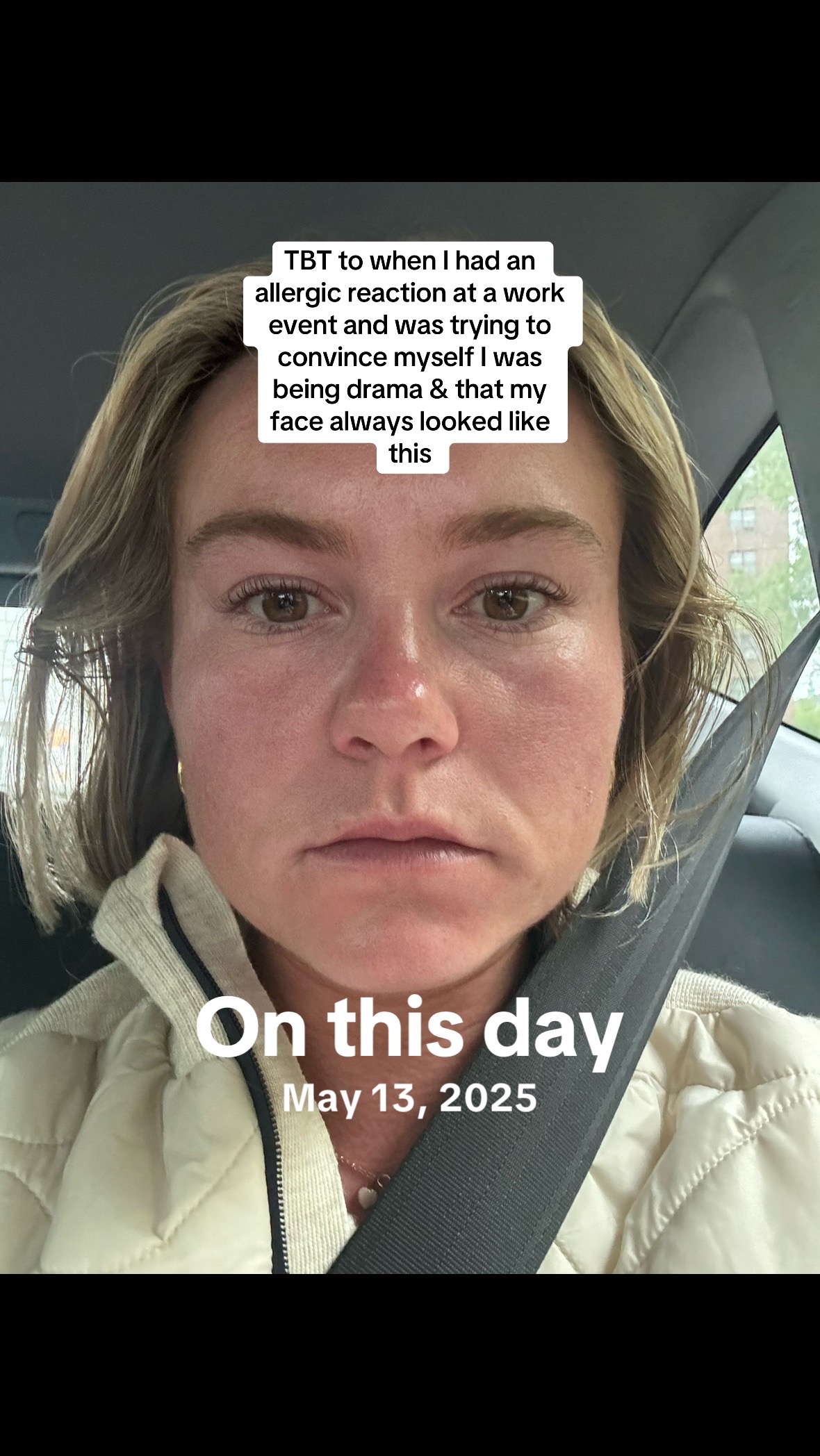 @Skinni