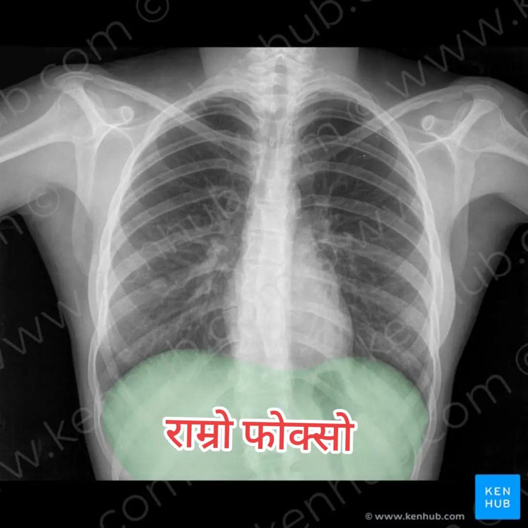 @DR.KIRAN CHANDRA PUN