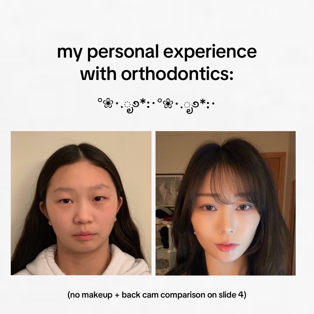 @niki