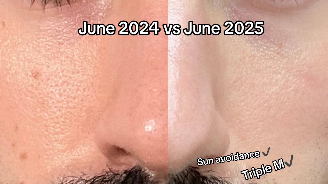 @FacebyPatrick
