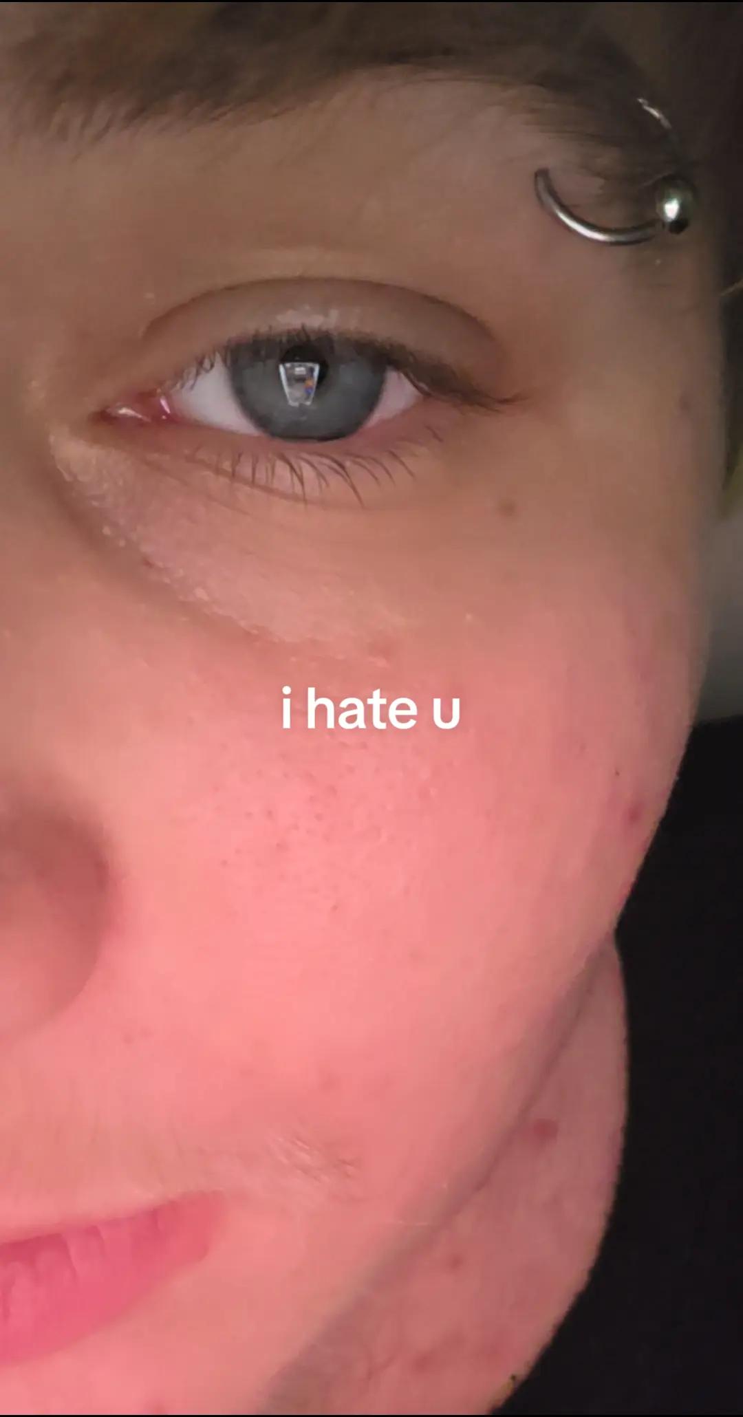 @Bugs✨️