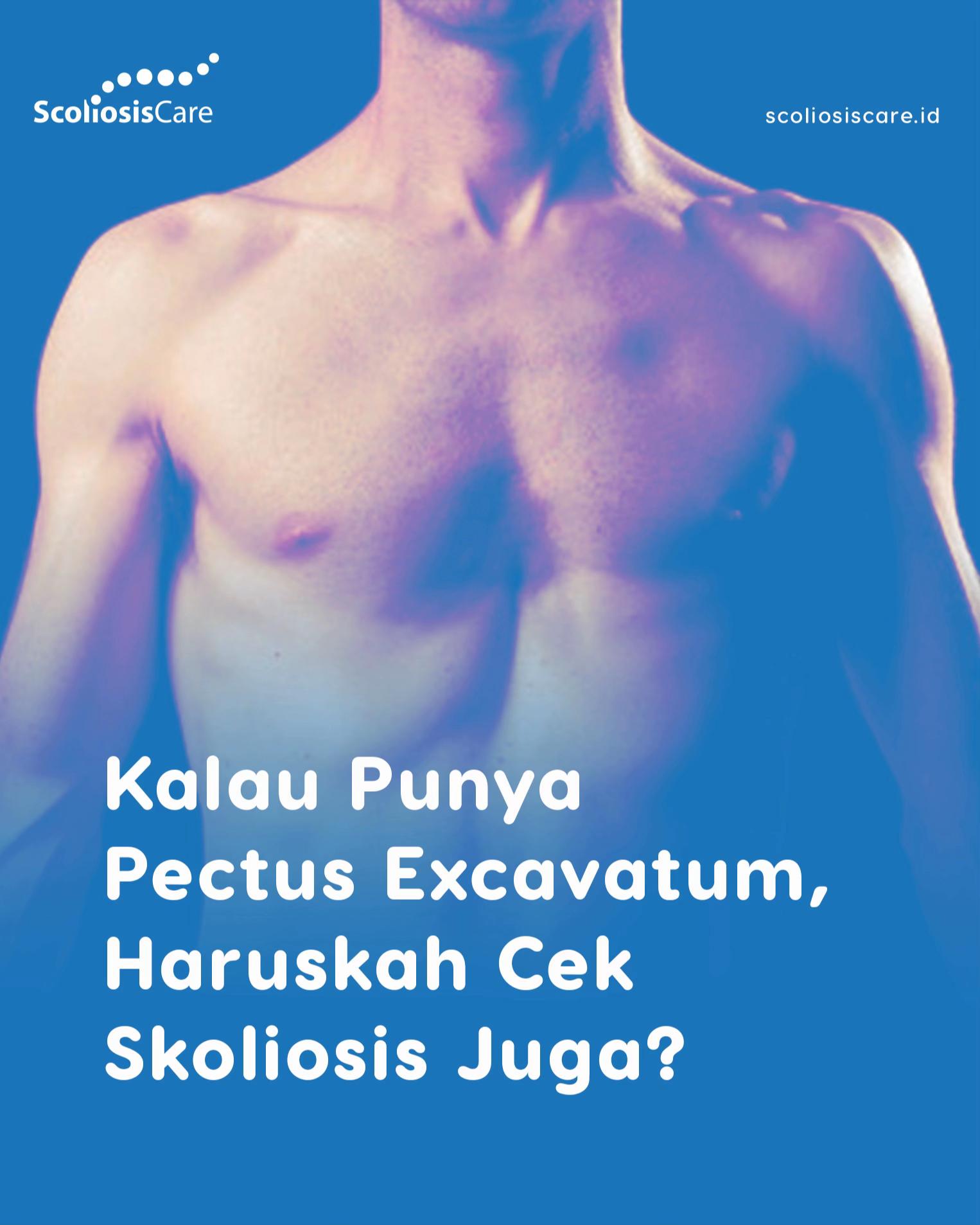 @Scoliosis Care