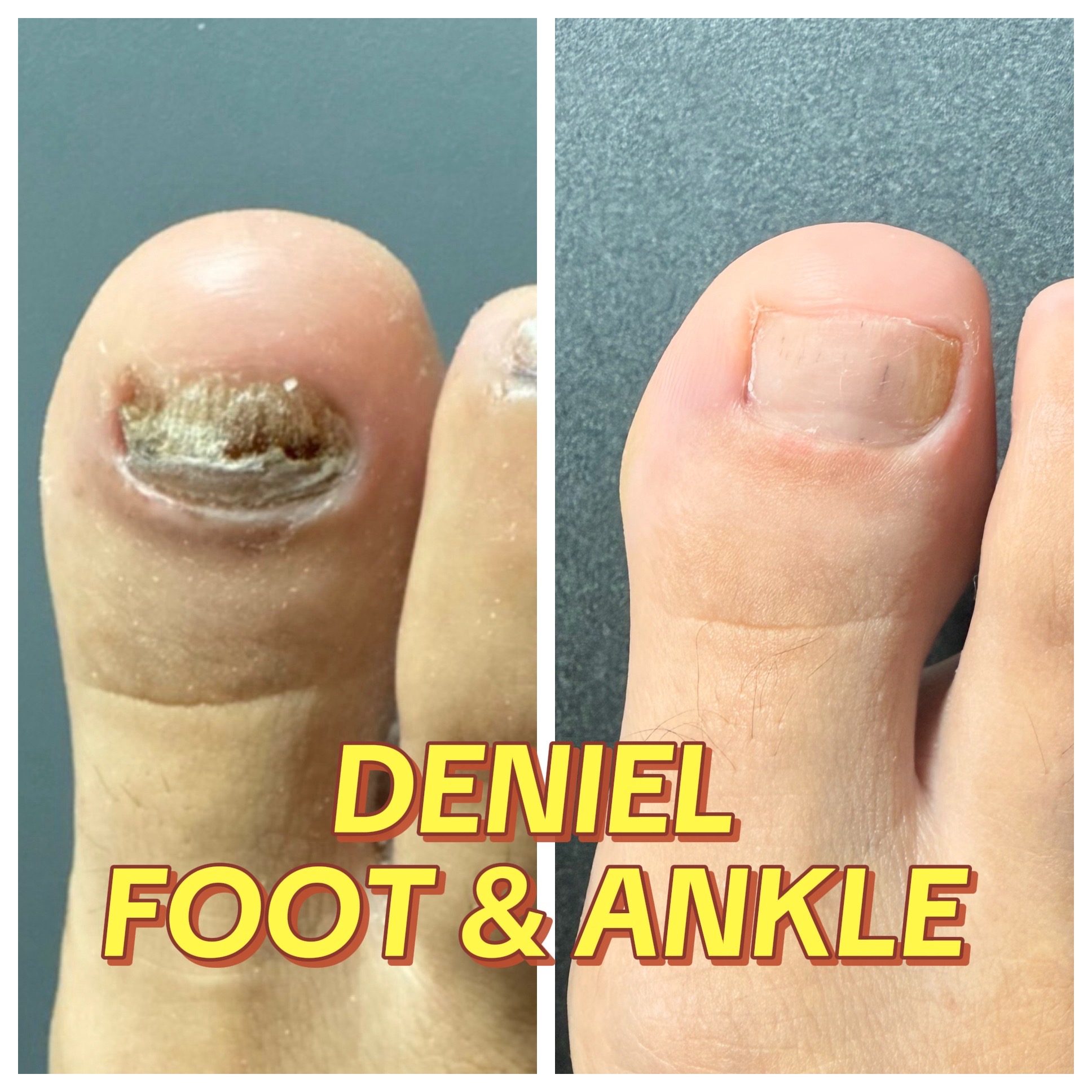 @Deniel Foot and Ankle Center