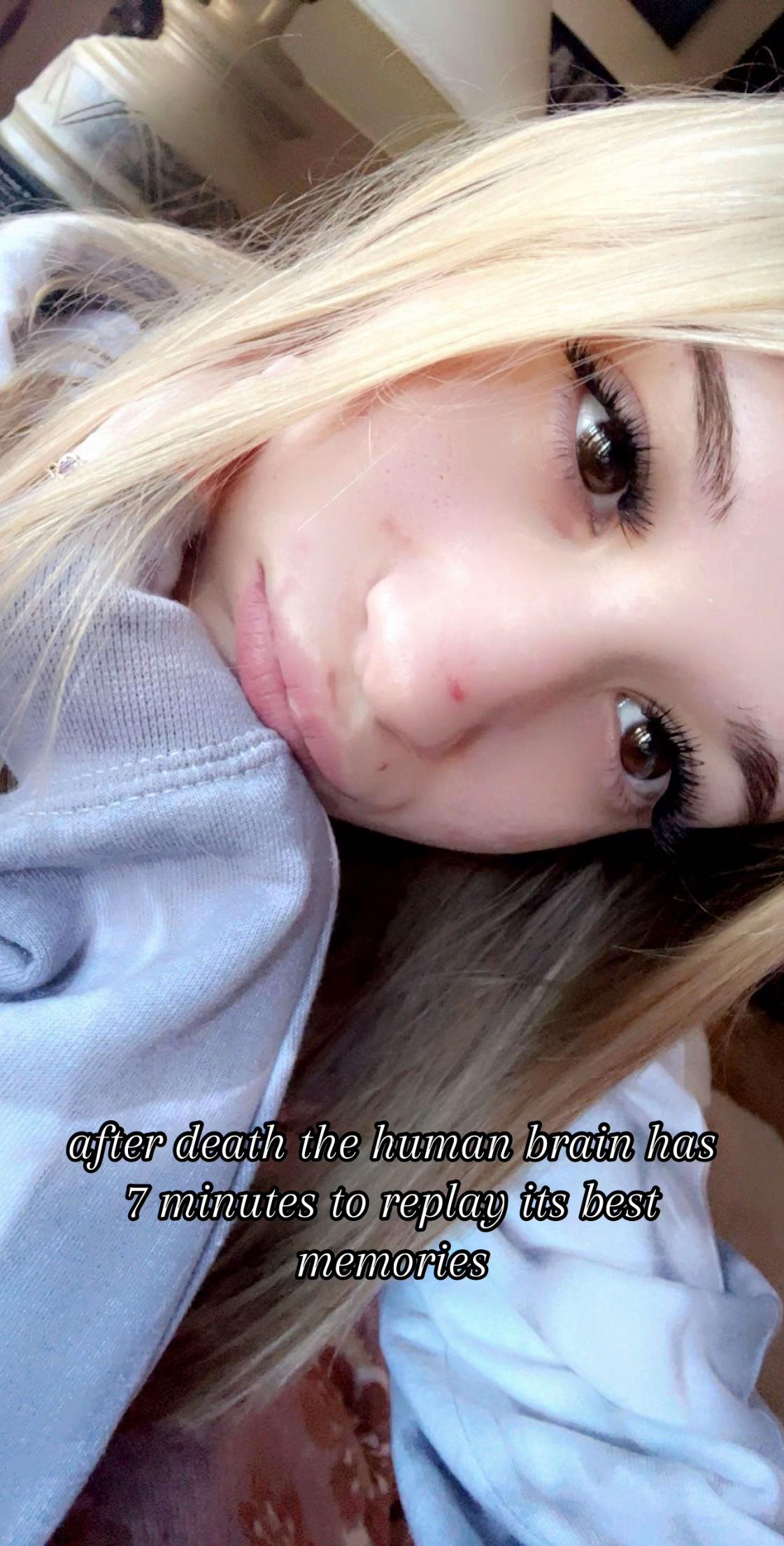 @🪱