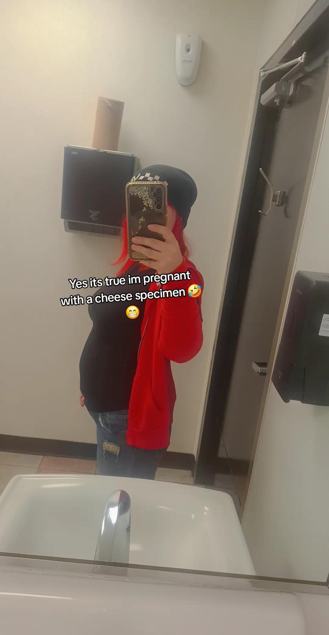 @Čhërrịị🍒🍒