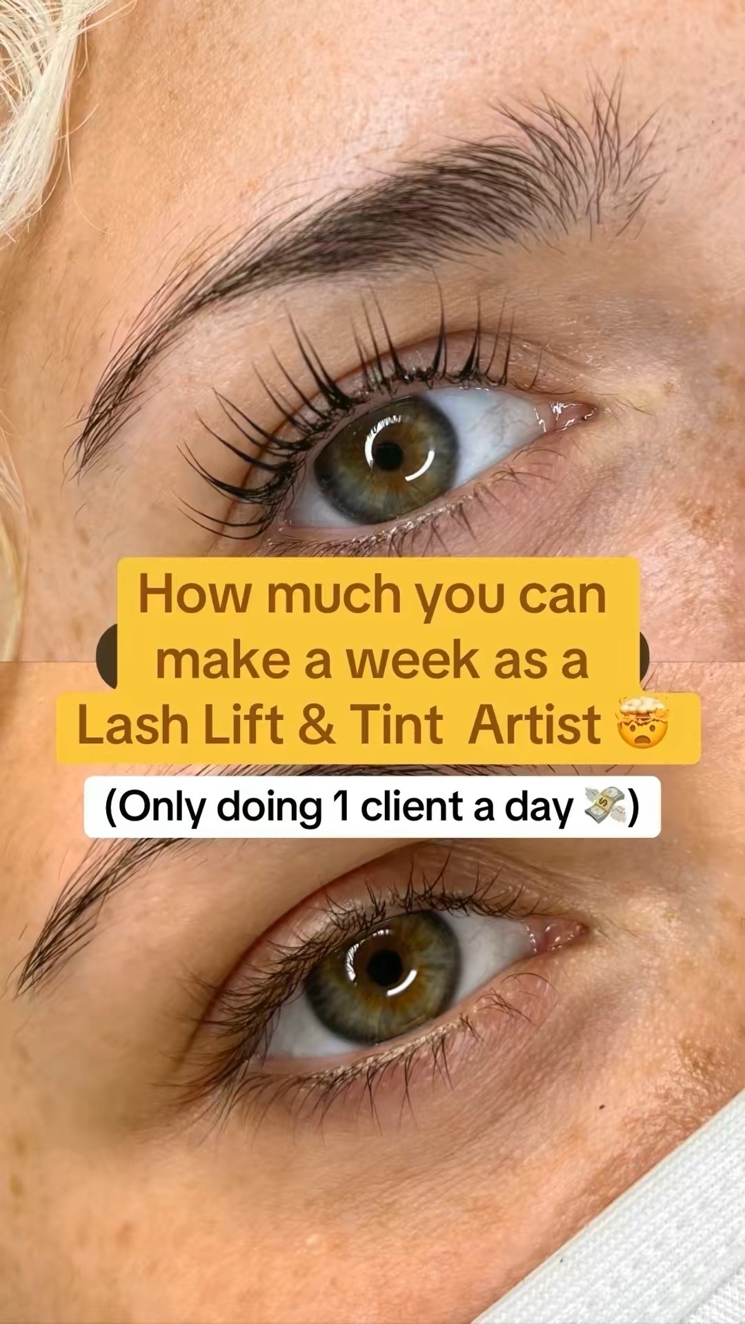 @Diandra | Teeth Whitening Tech
