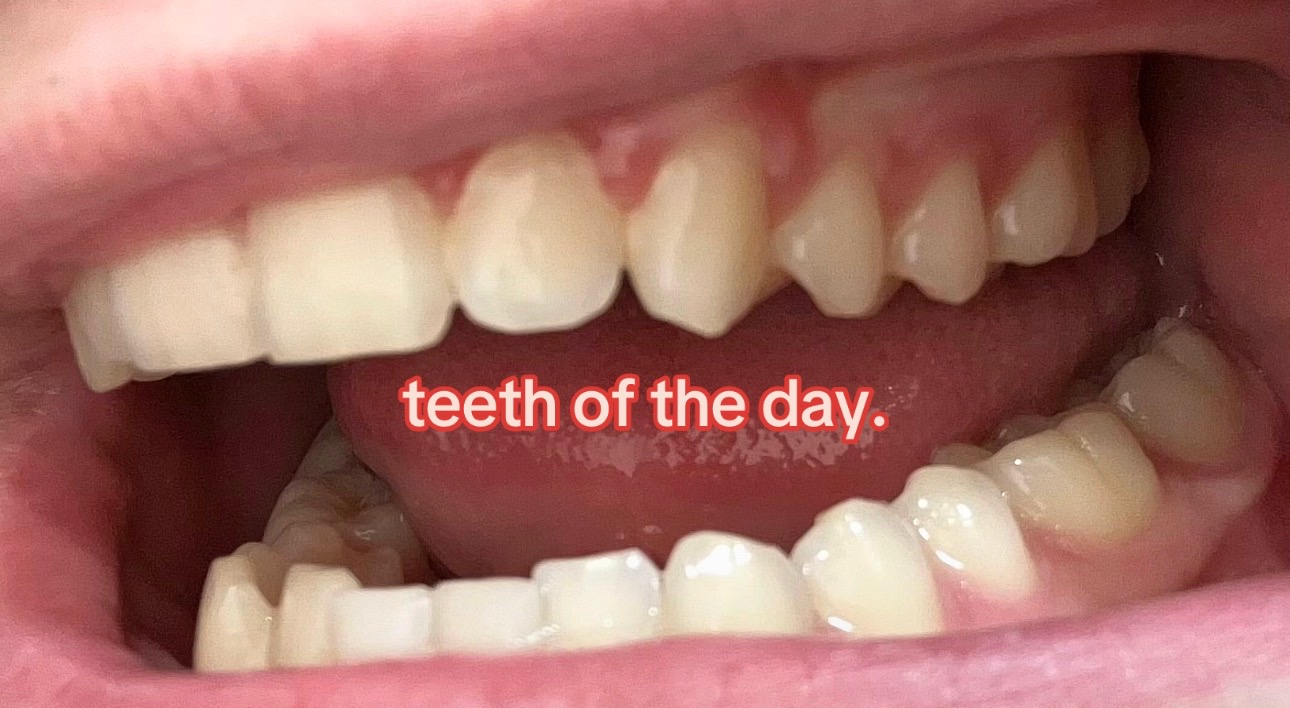 @I leik teeth moer thna mysefl.