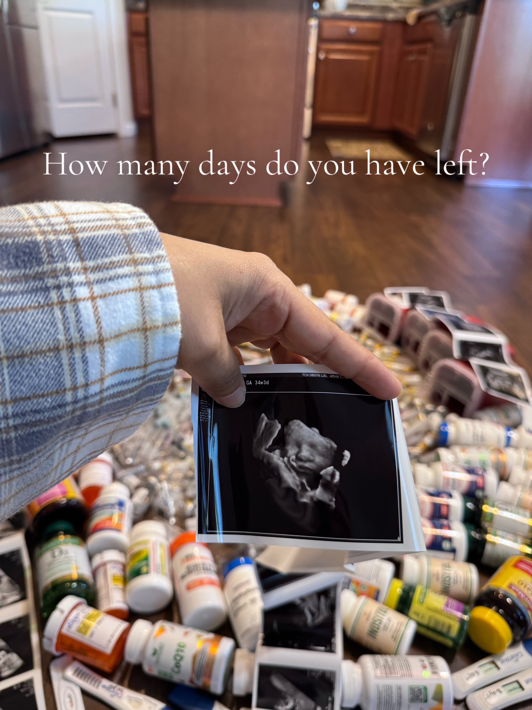 @Apsara | IVF MOM